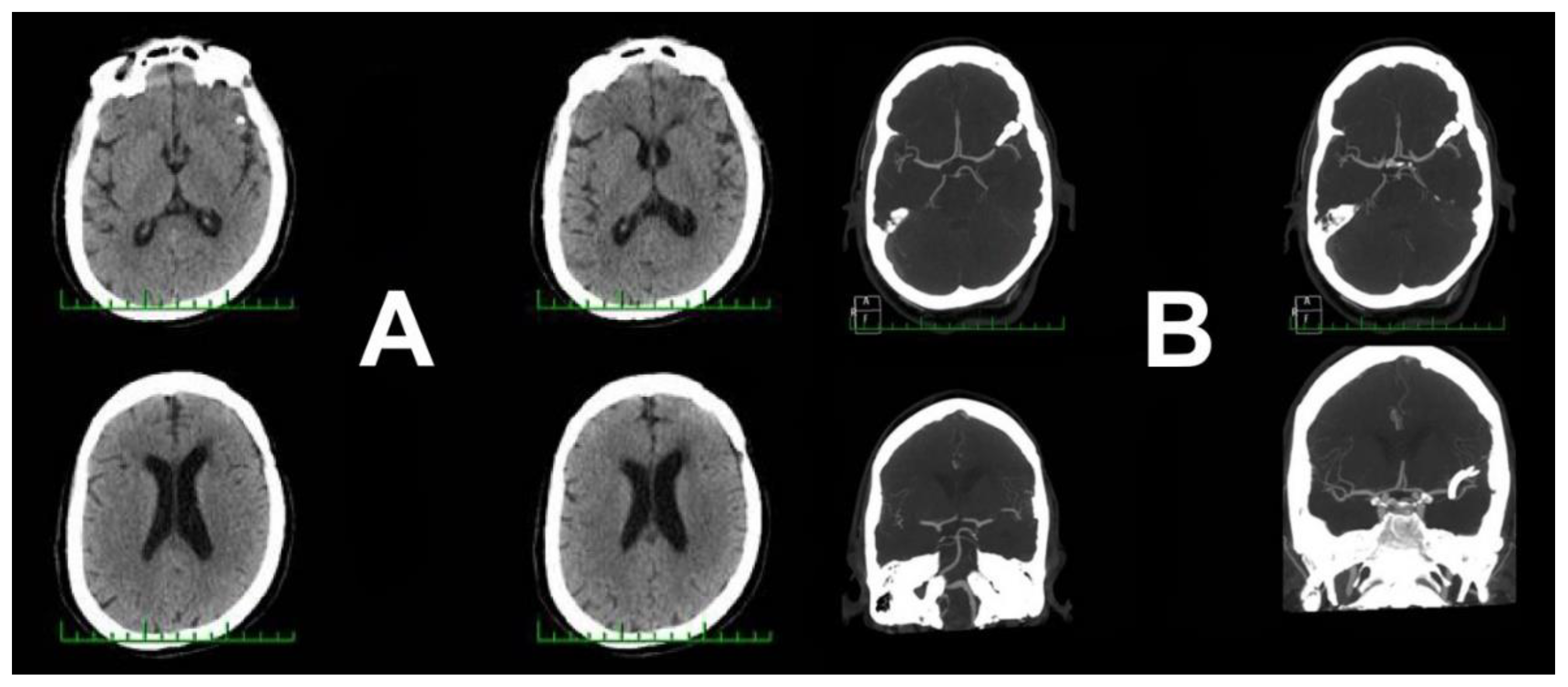 Brainsci 10 00495 g004 Brainsci 10 00495 g004