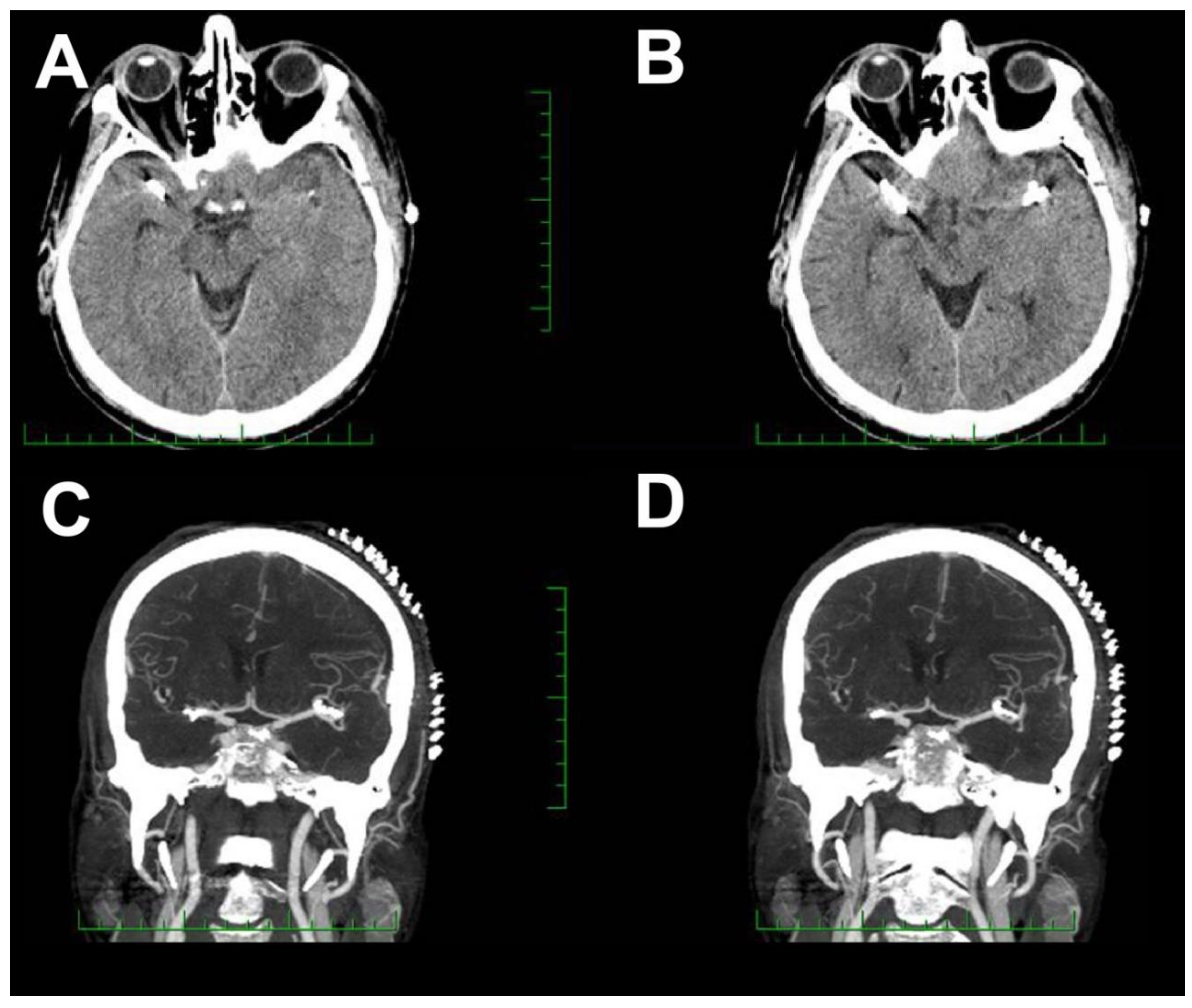 Brainsci 10 00495 g006 Brainsci 10 00495 g006