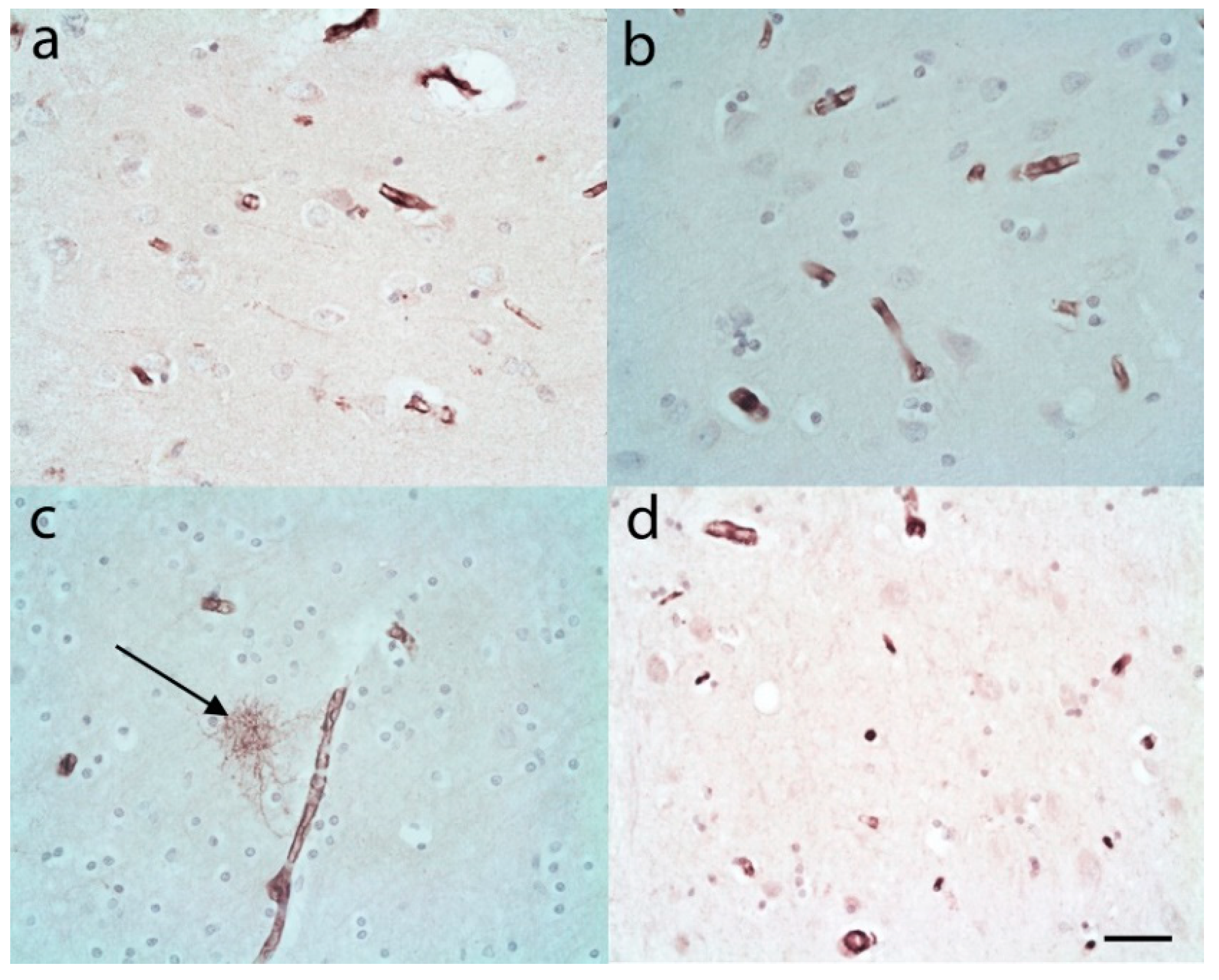 Brainsci 10 00503 g004 Brainsci 10 00503 g004