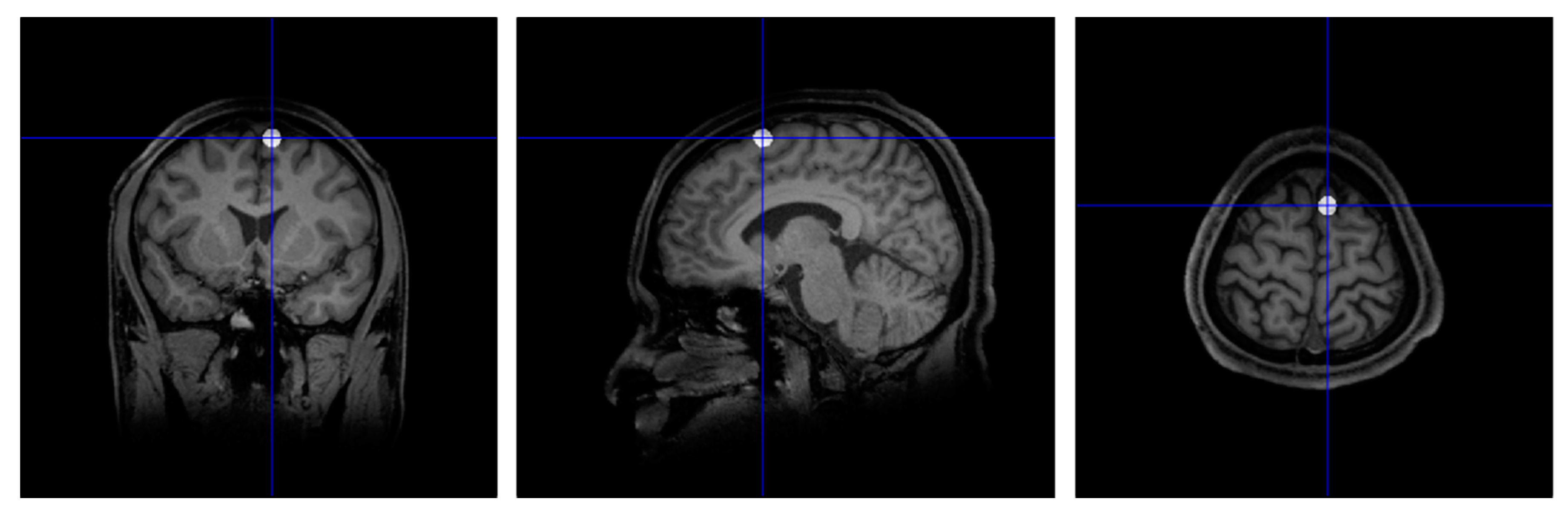 Brainsci 10 00517 g005