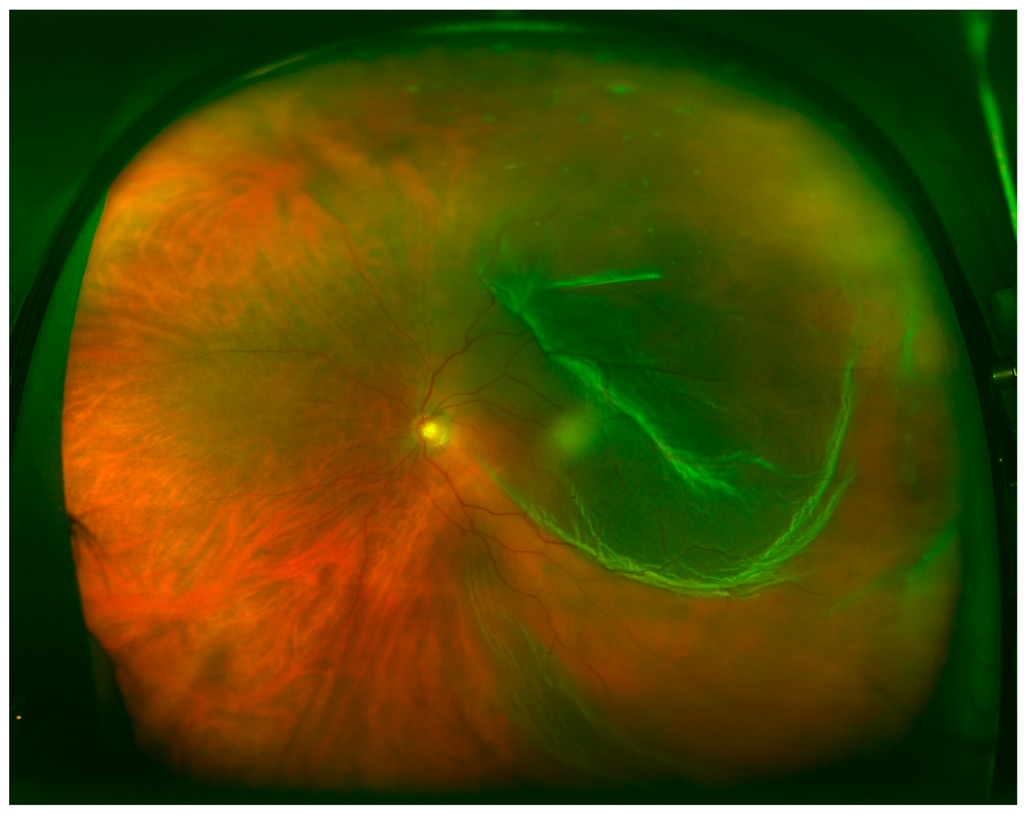 Brainsci 10 00521 g004