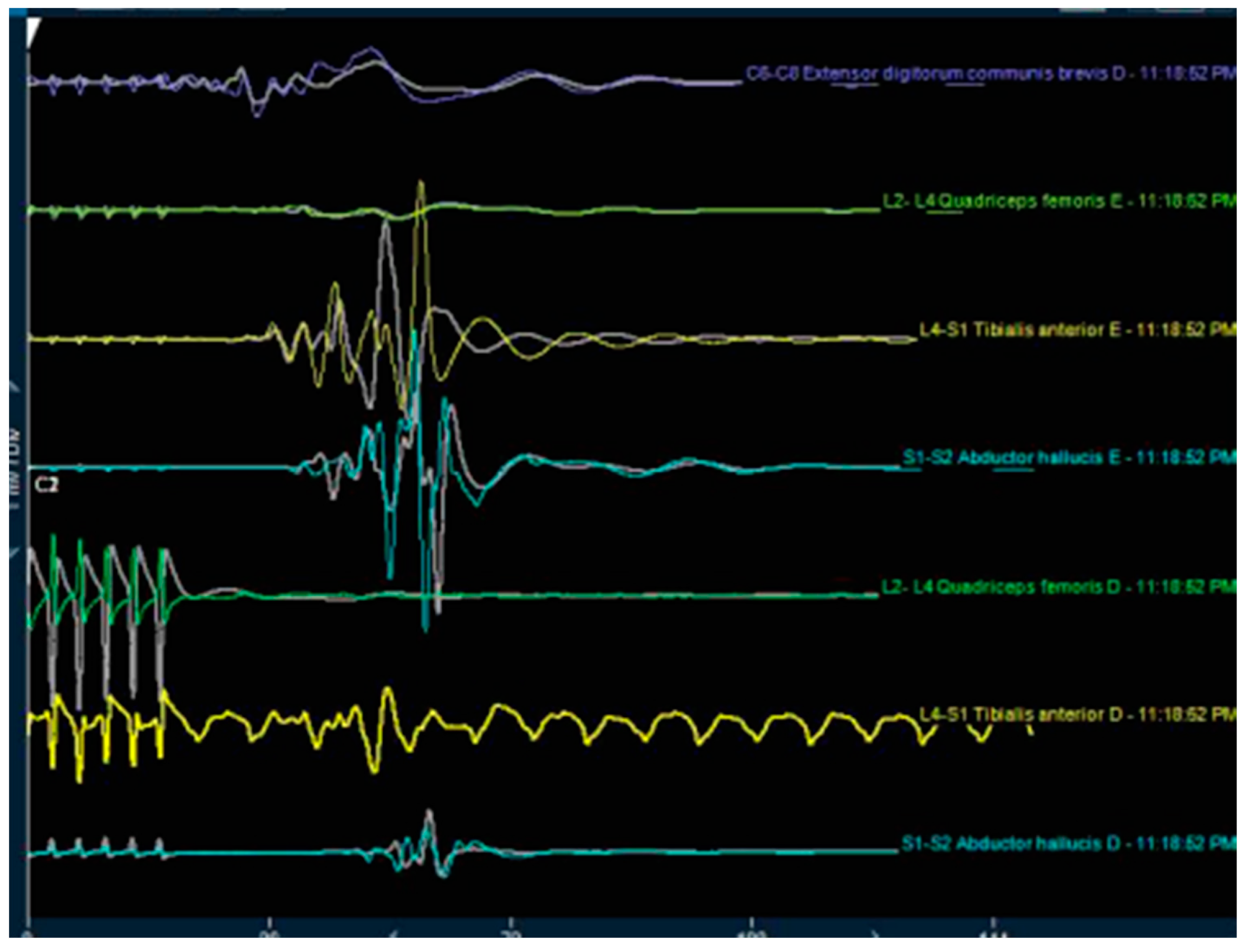 Brainsci 10 00522 g003