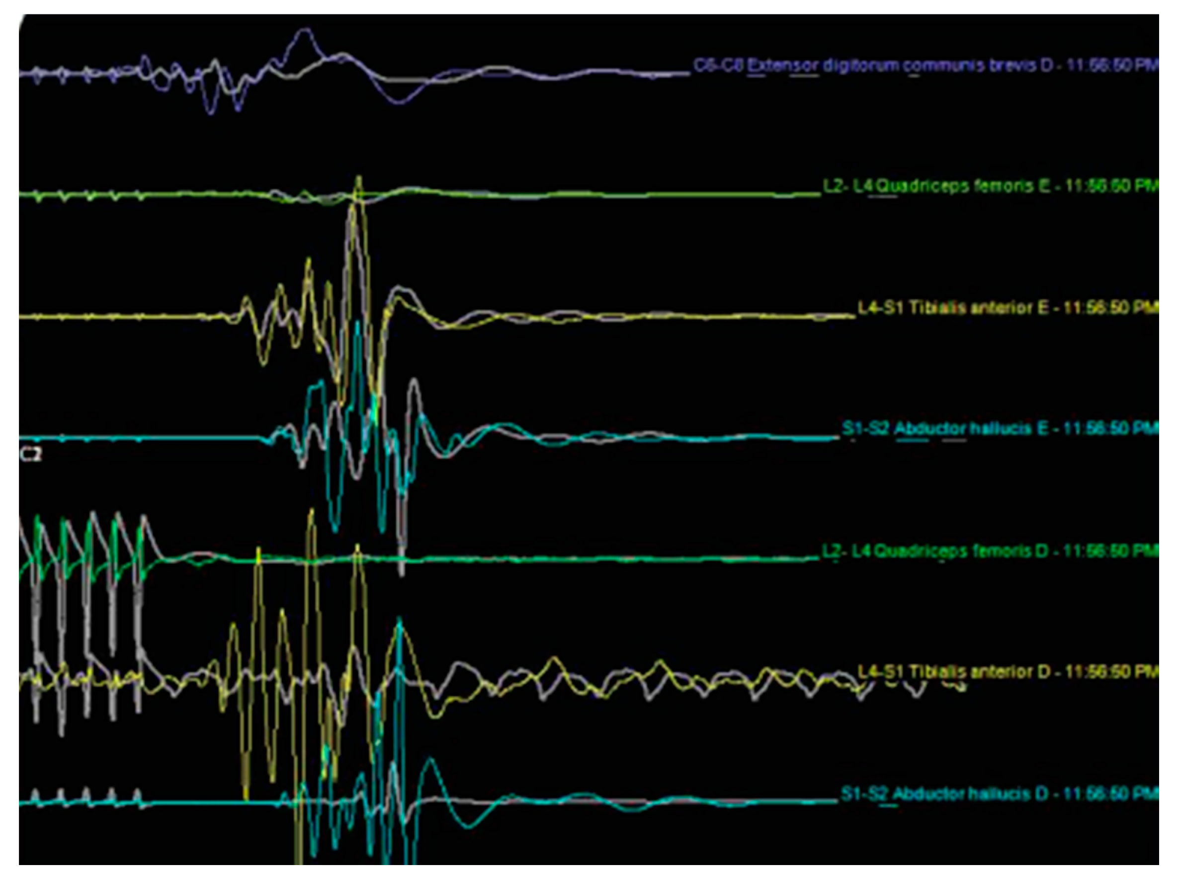 Brainsci 10 00522 g004