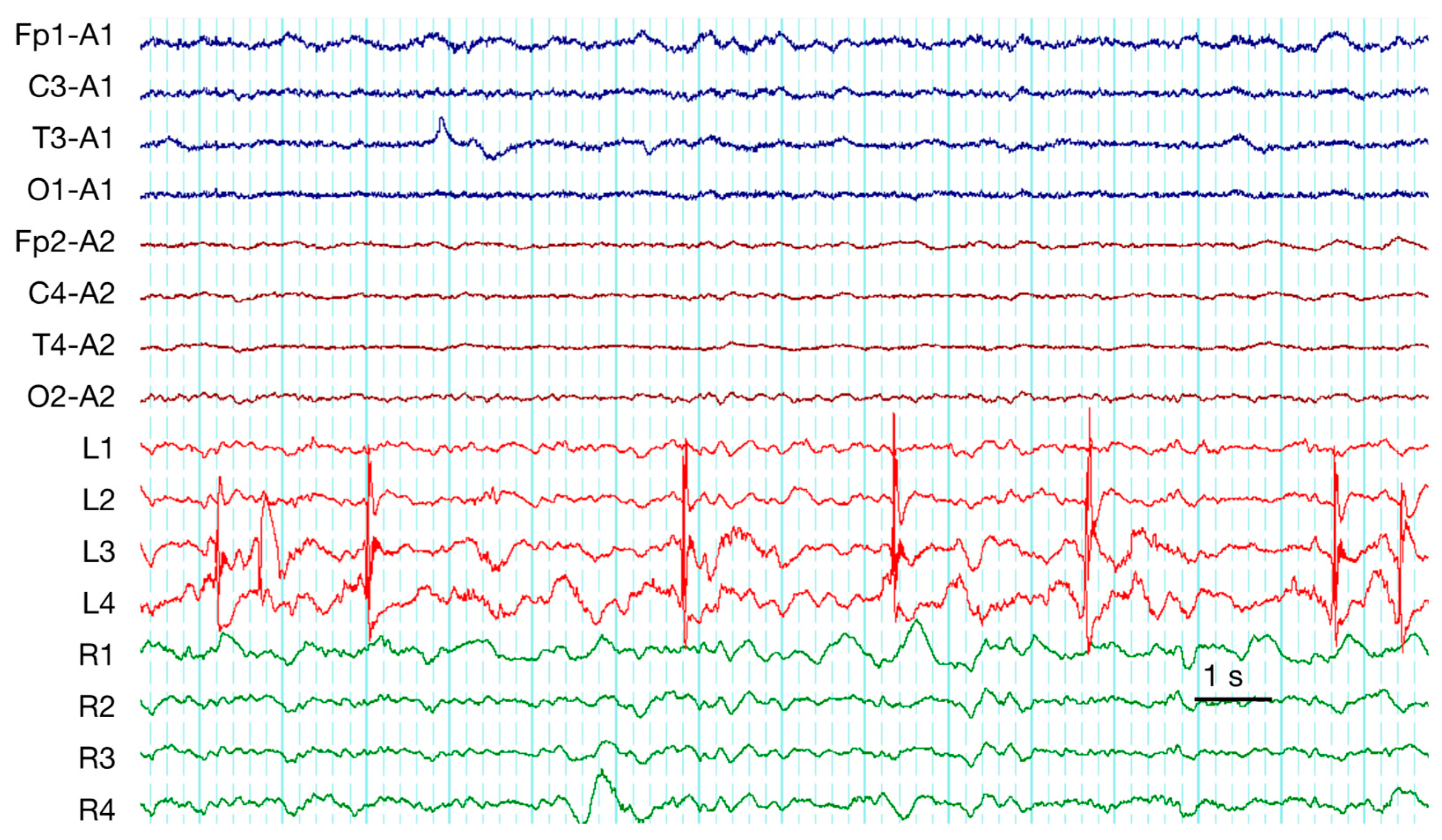 Brainsci 10 00570 g002