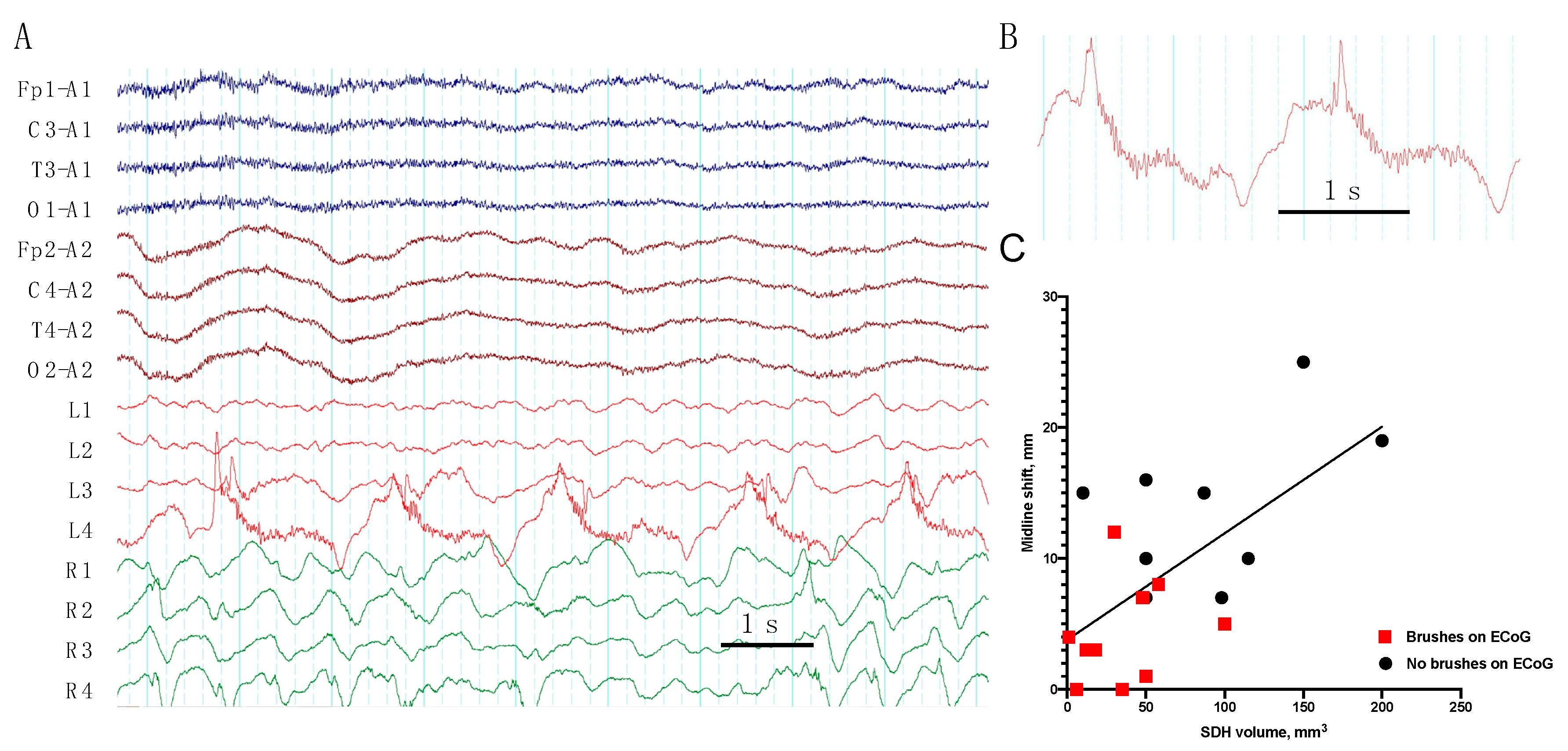 Brainsci 10 00570 g004