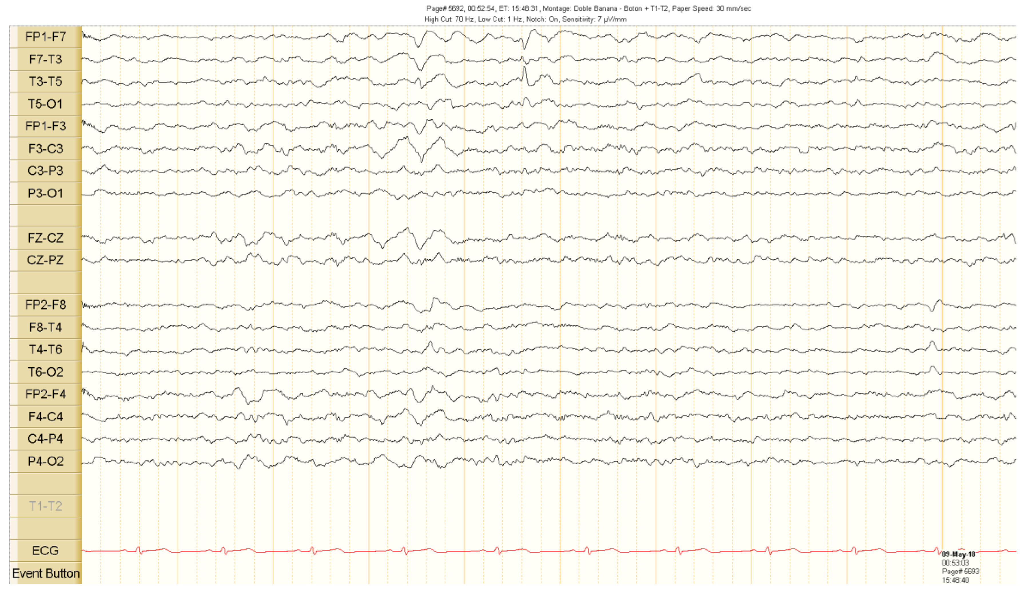 Brainsci 10 00584 g001