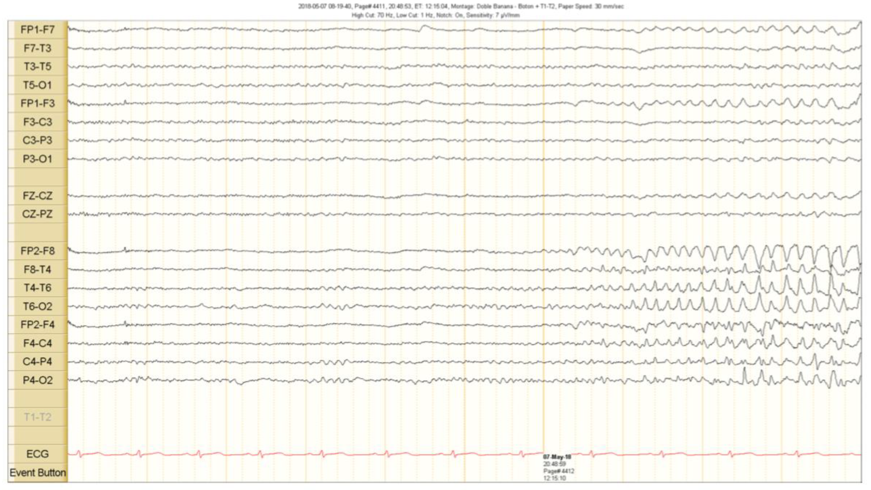 Brainsci 10 00584 g002