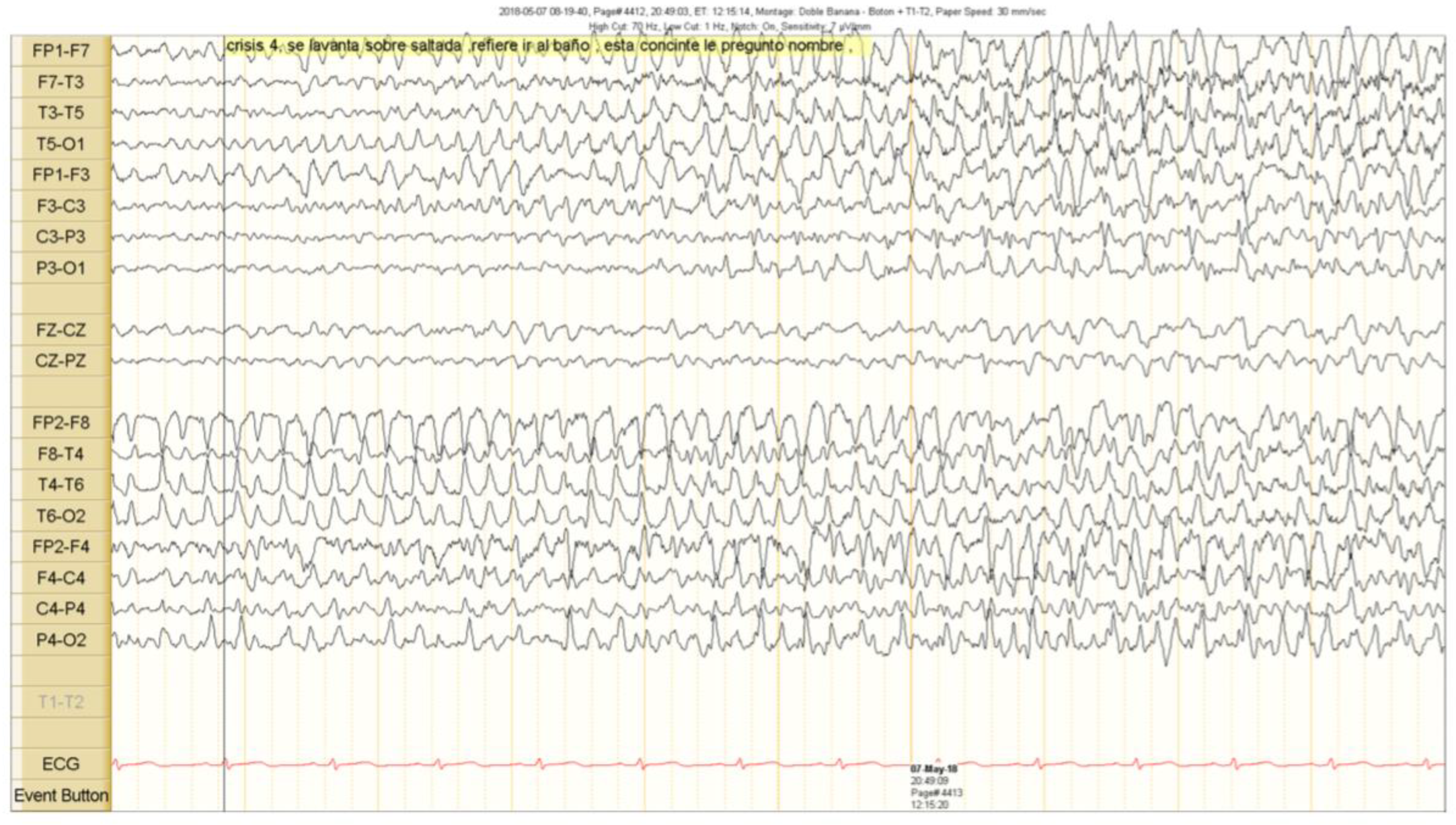 Brainsci 10 00584 g003