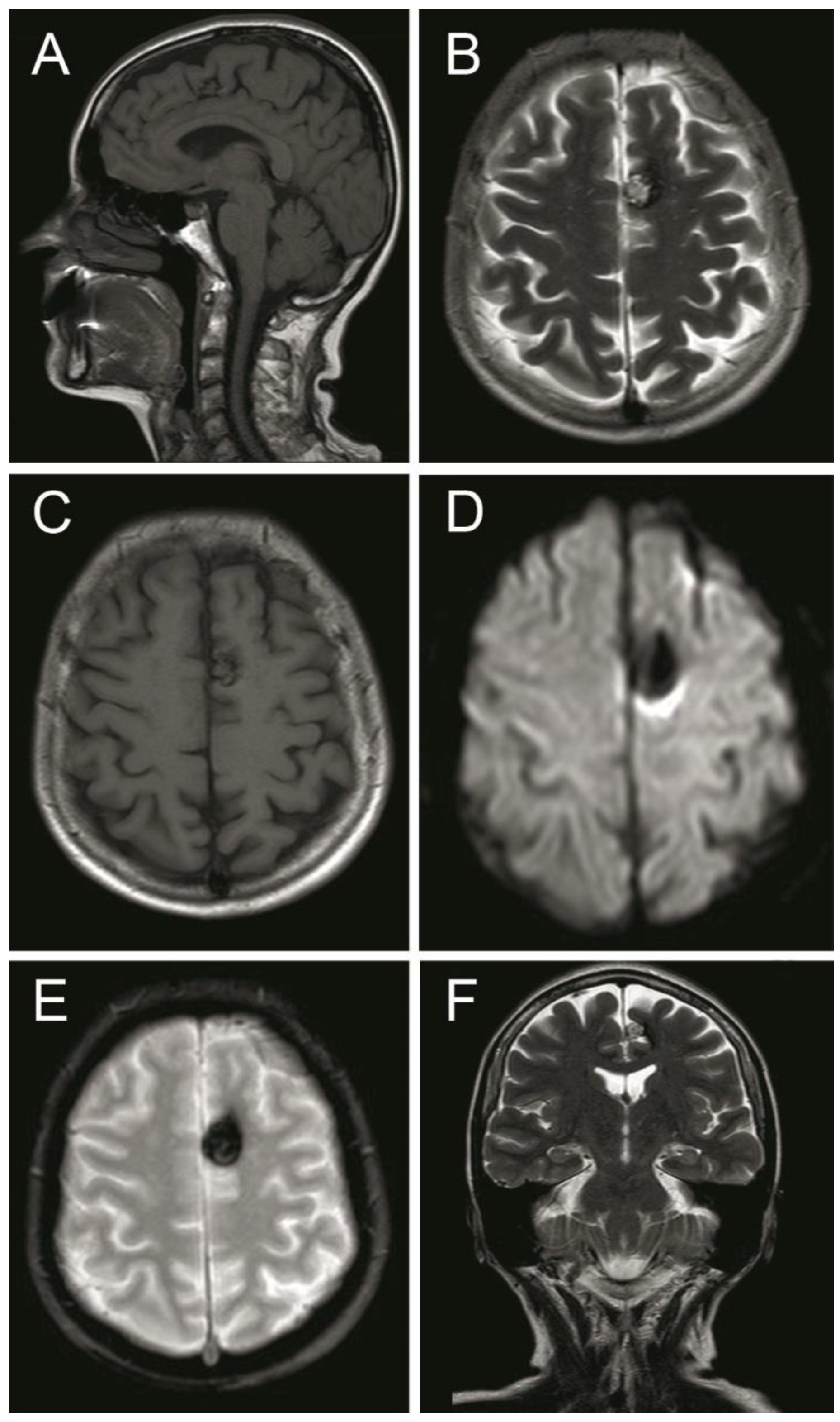 Brainsci 10 00584 g004