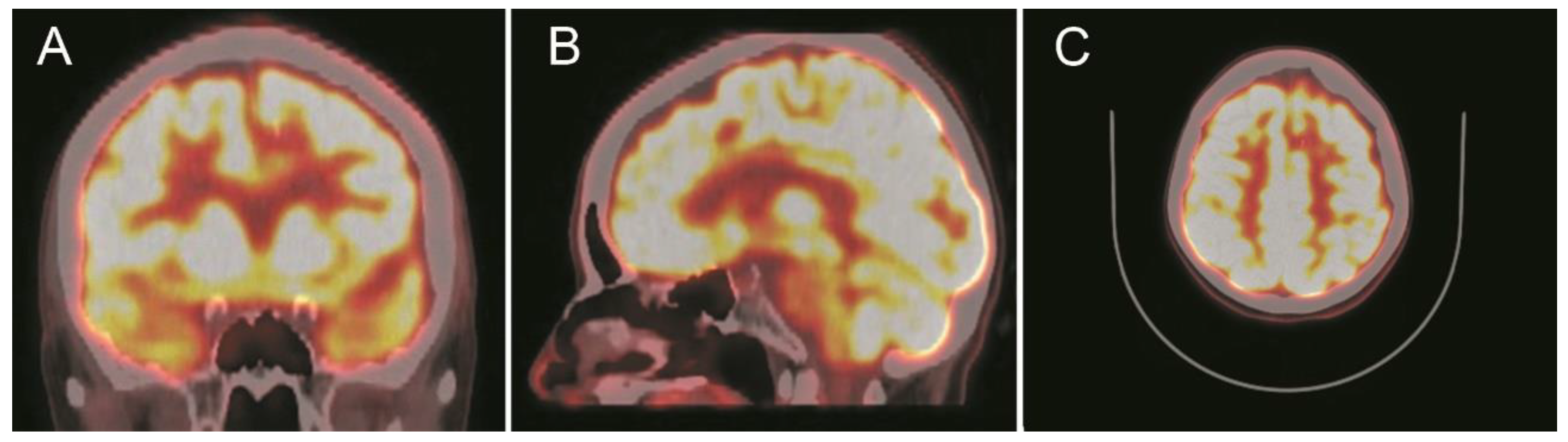 Brainsci 10 00584 g005