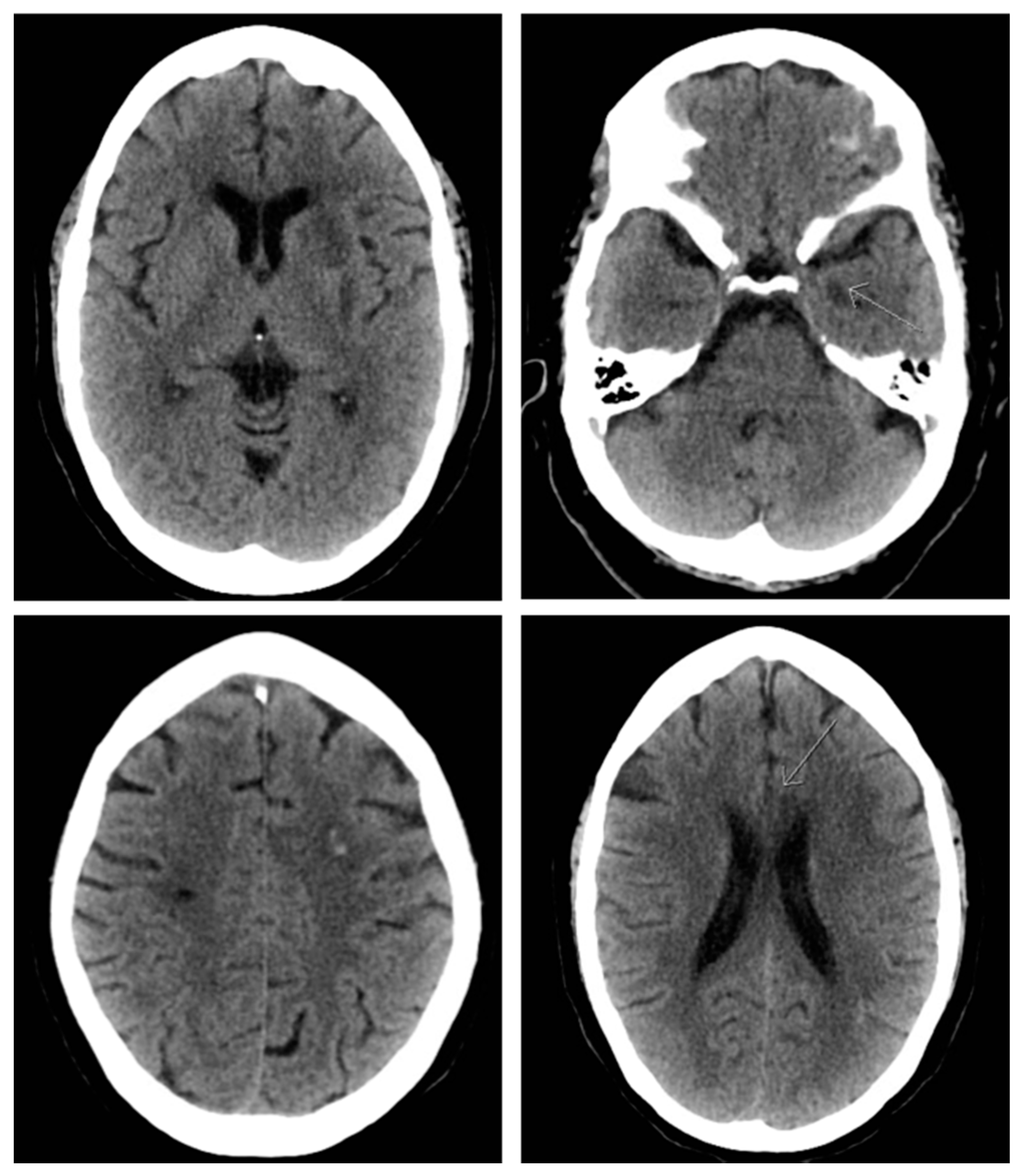 Brainsci 10 00590 g003