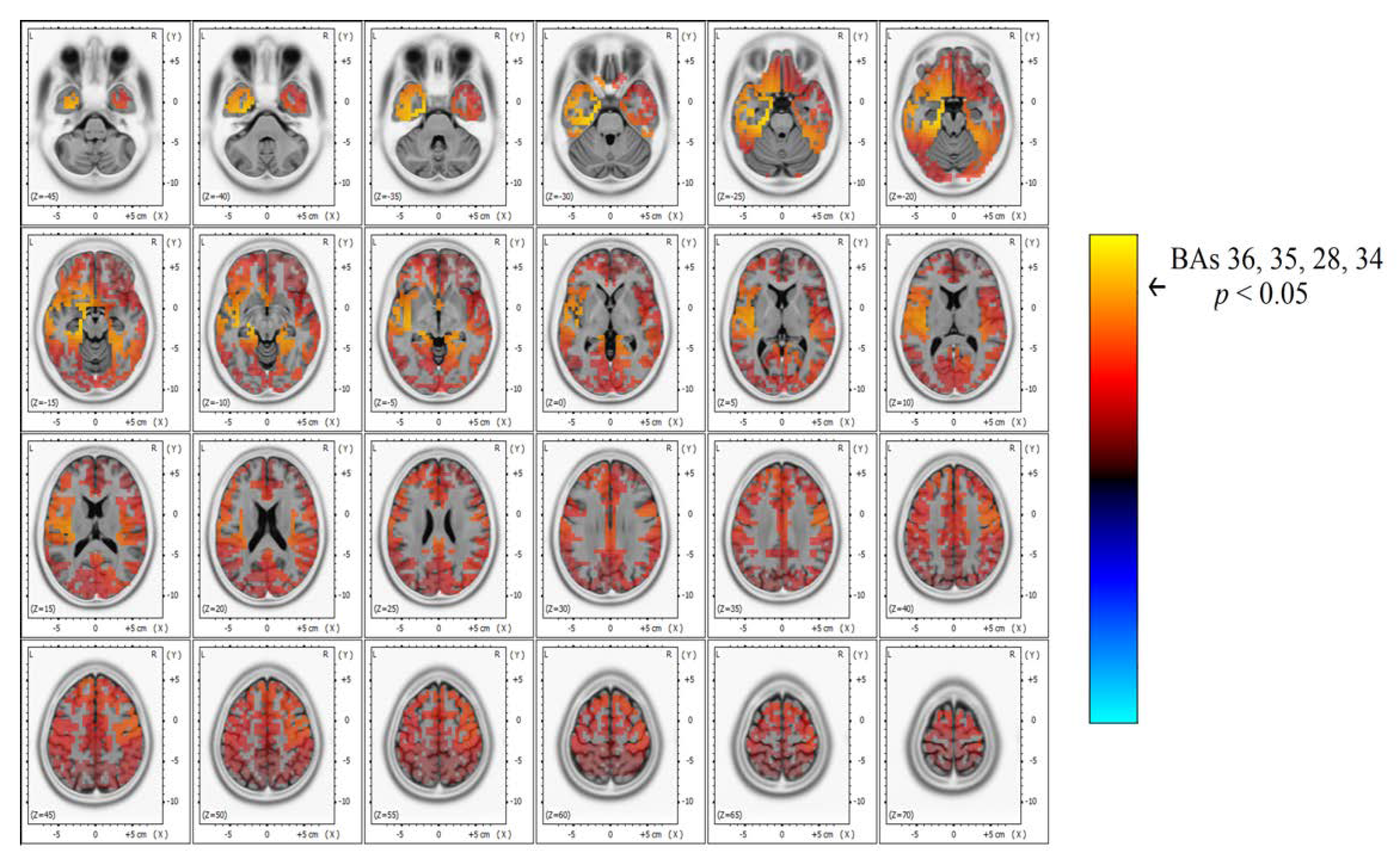 Brainsci 10 00613 g004