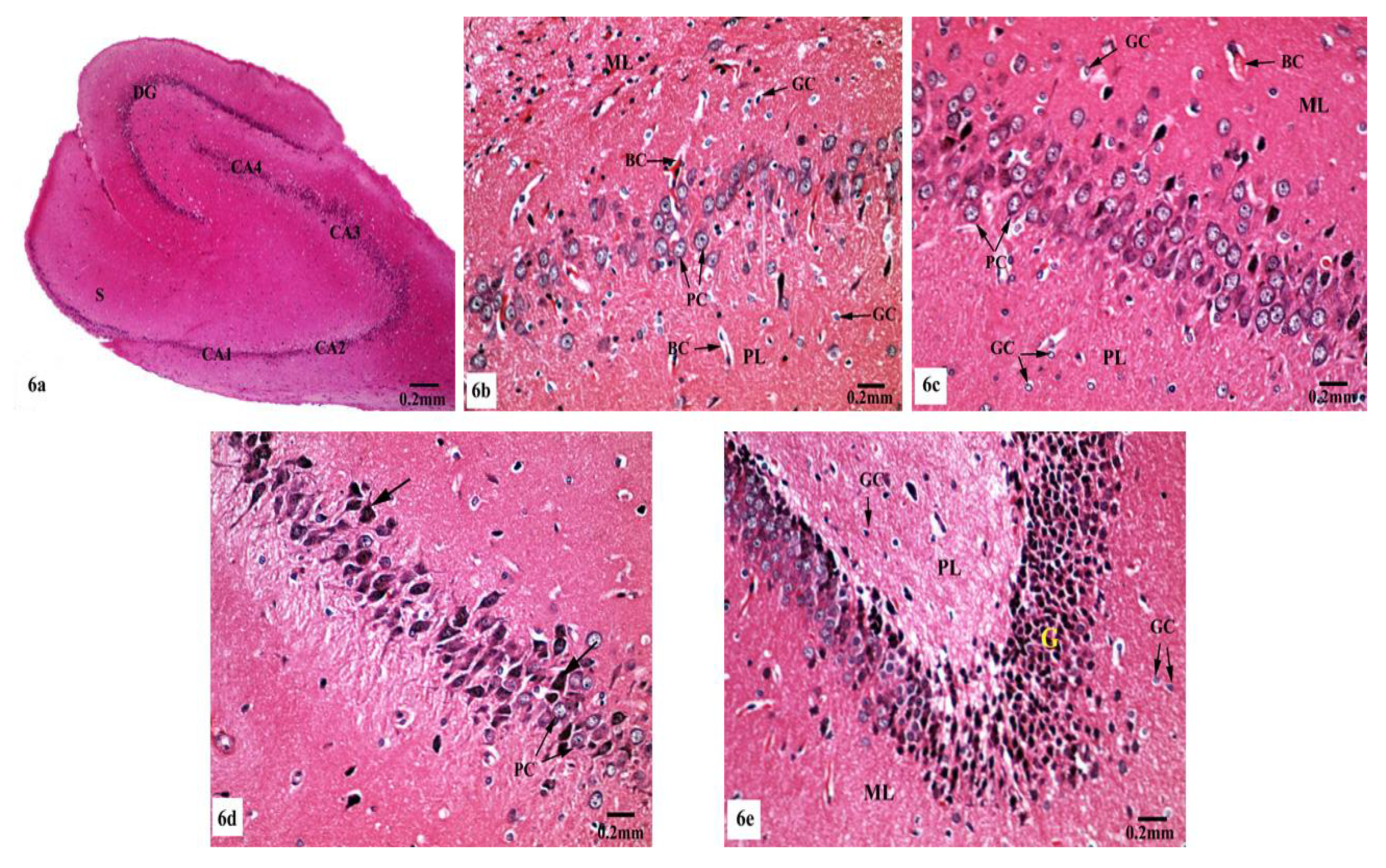 Brainsci 10 00628 g006