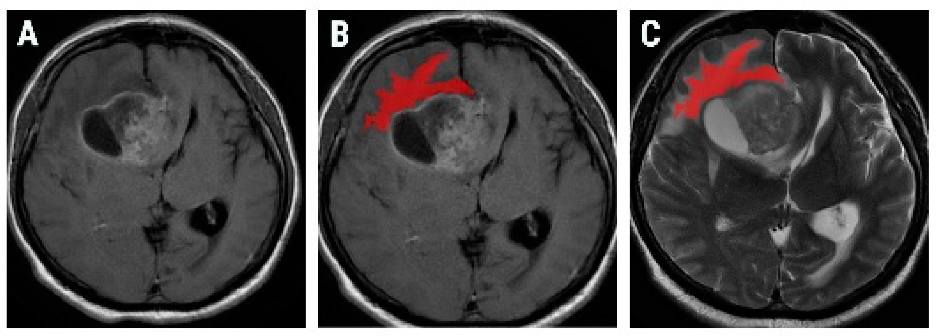 Brainsci 10 00638 g002