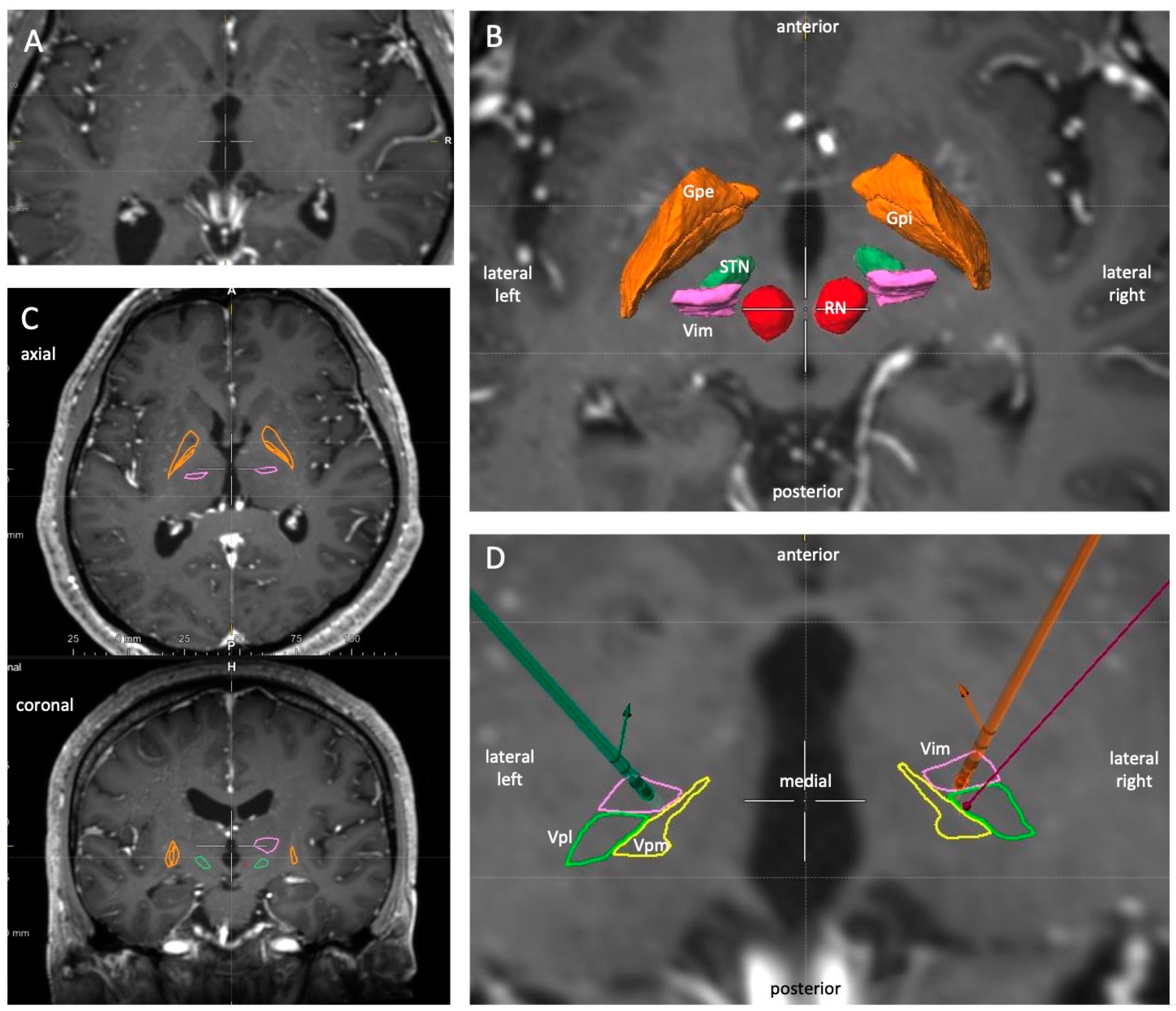 Brainsci 10 00642 g001