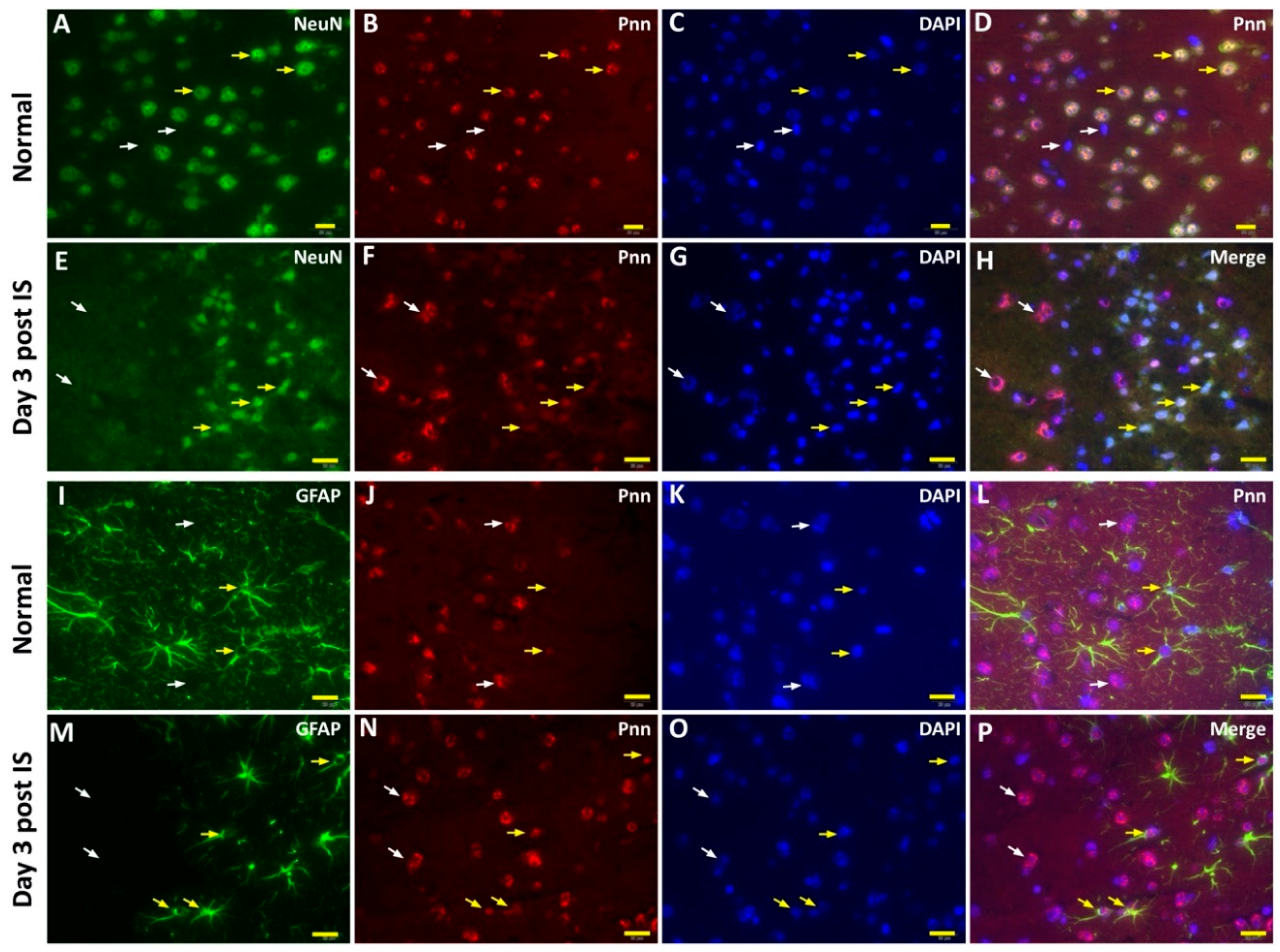 Brainsci 10 00708 g005