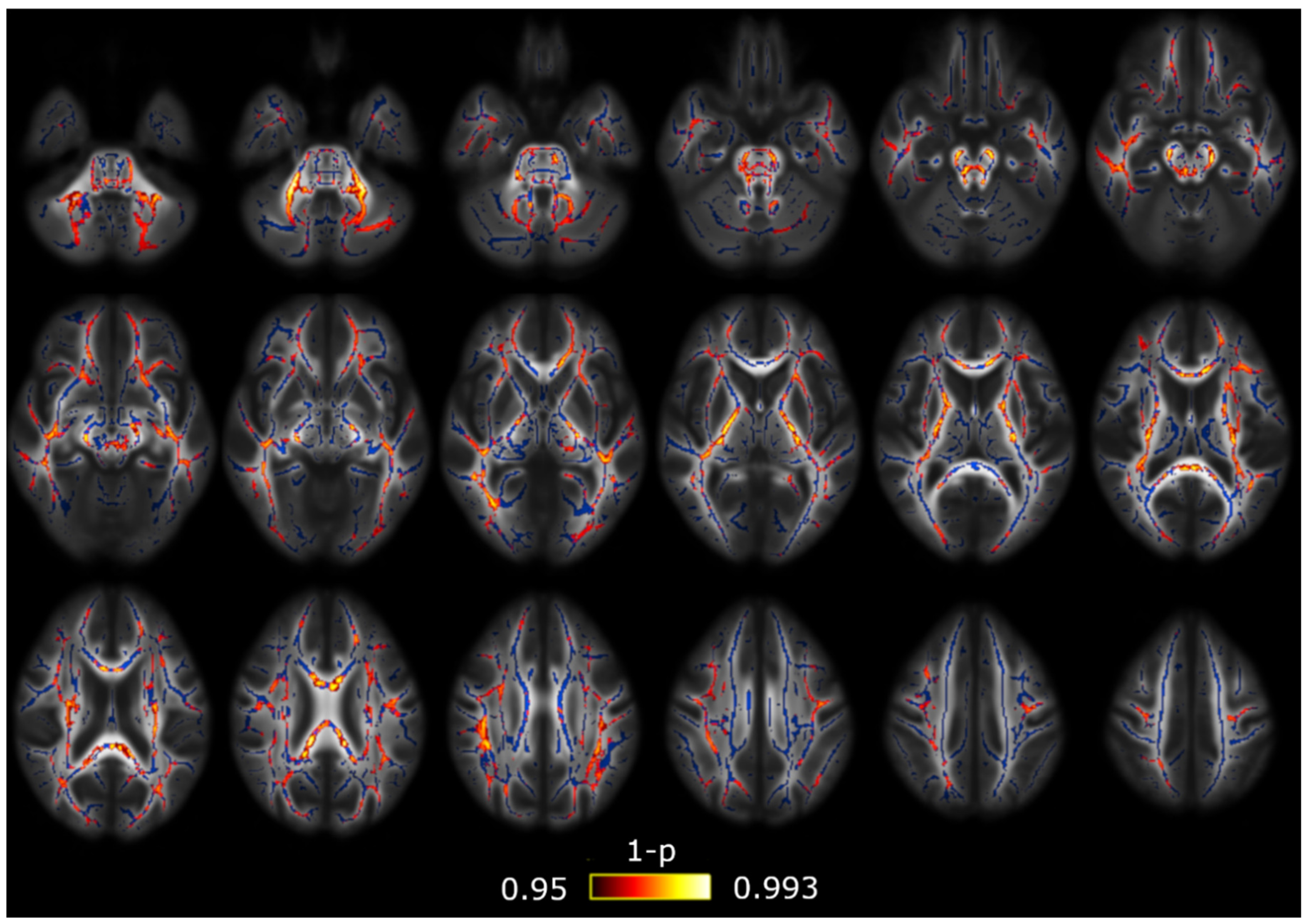 Brainsci 10 00711 g002 Brainsci 10 00711 g002
