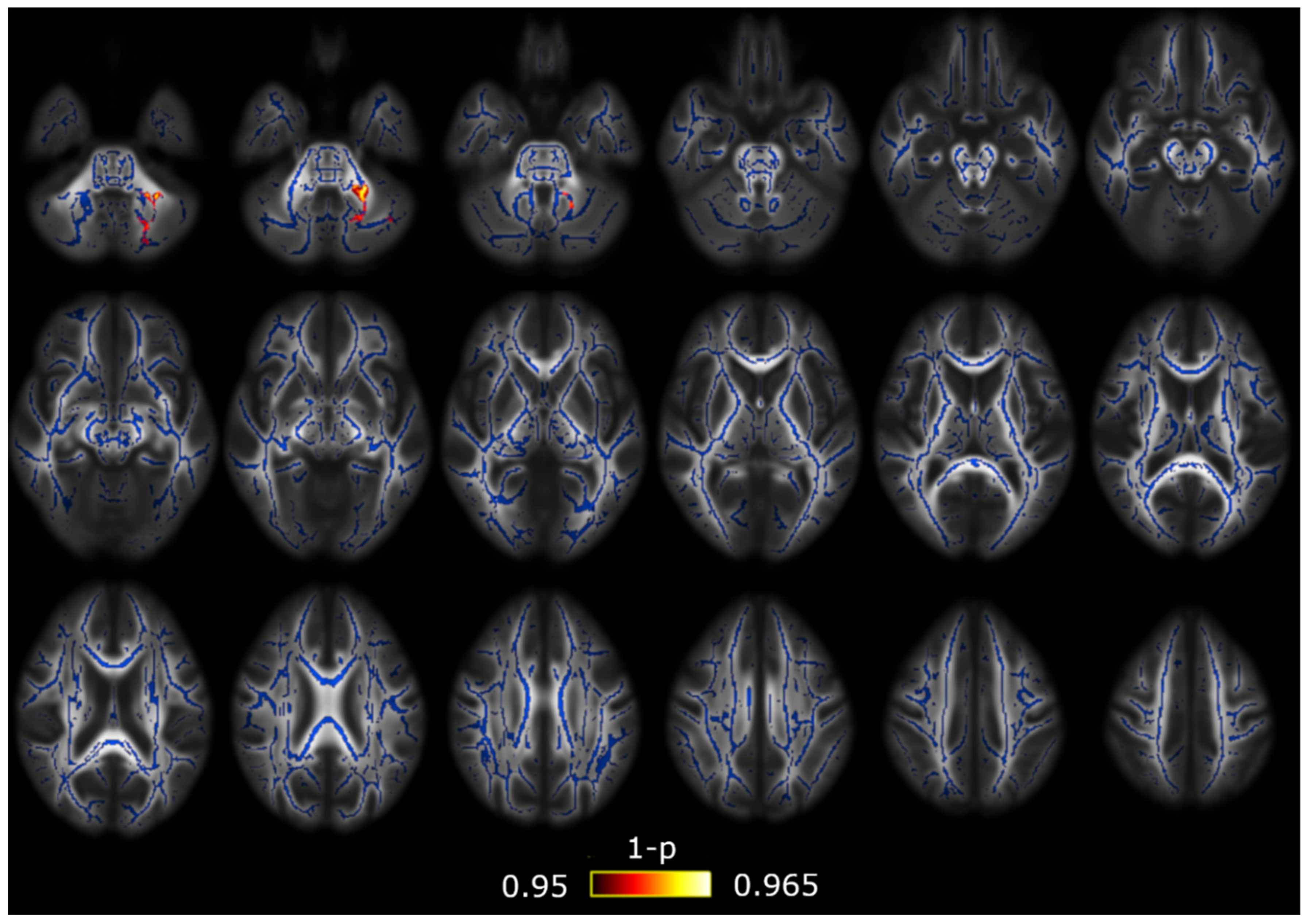 Brainsci 10 00711 g003 Brainsci 10 00711 g003