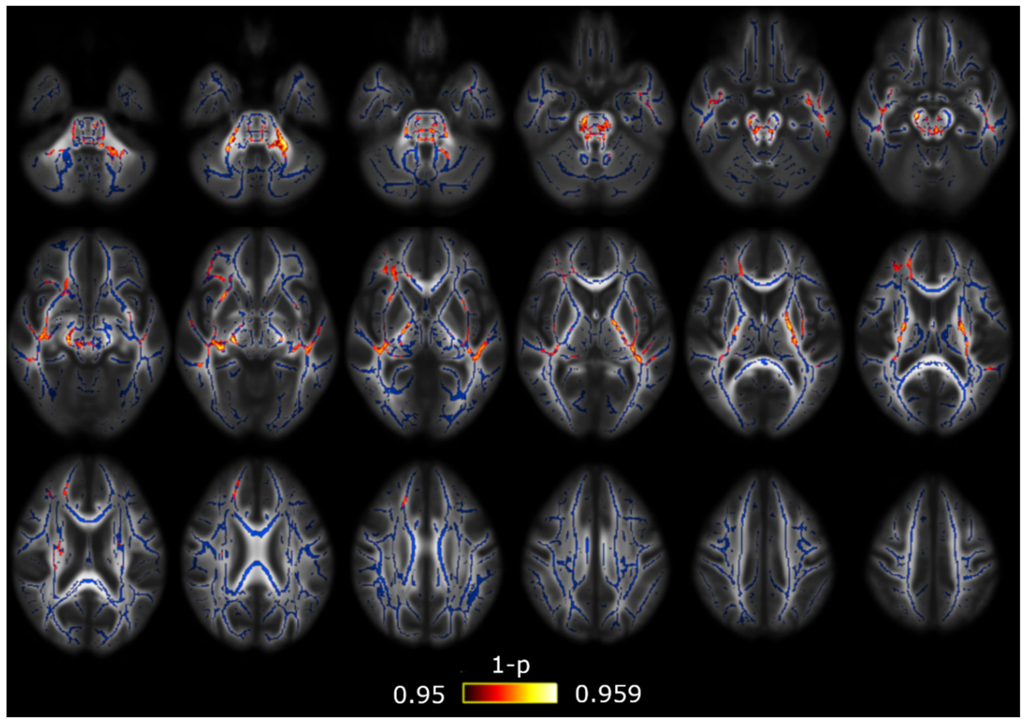 Brainsci 10 00711 g004 Brainsci 10 00711 g004