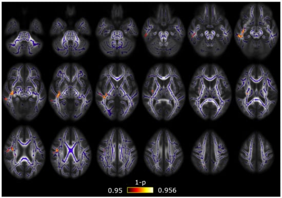 Brainsci 10 00711 g0a2