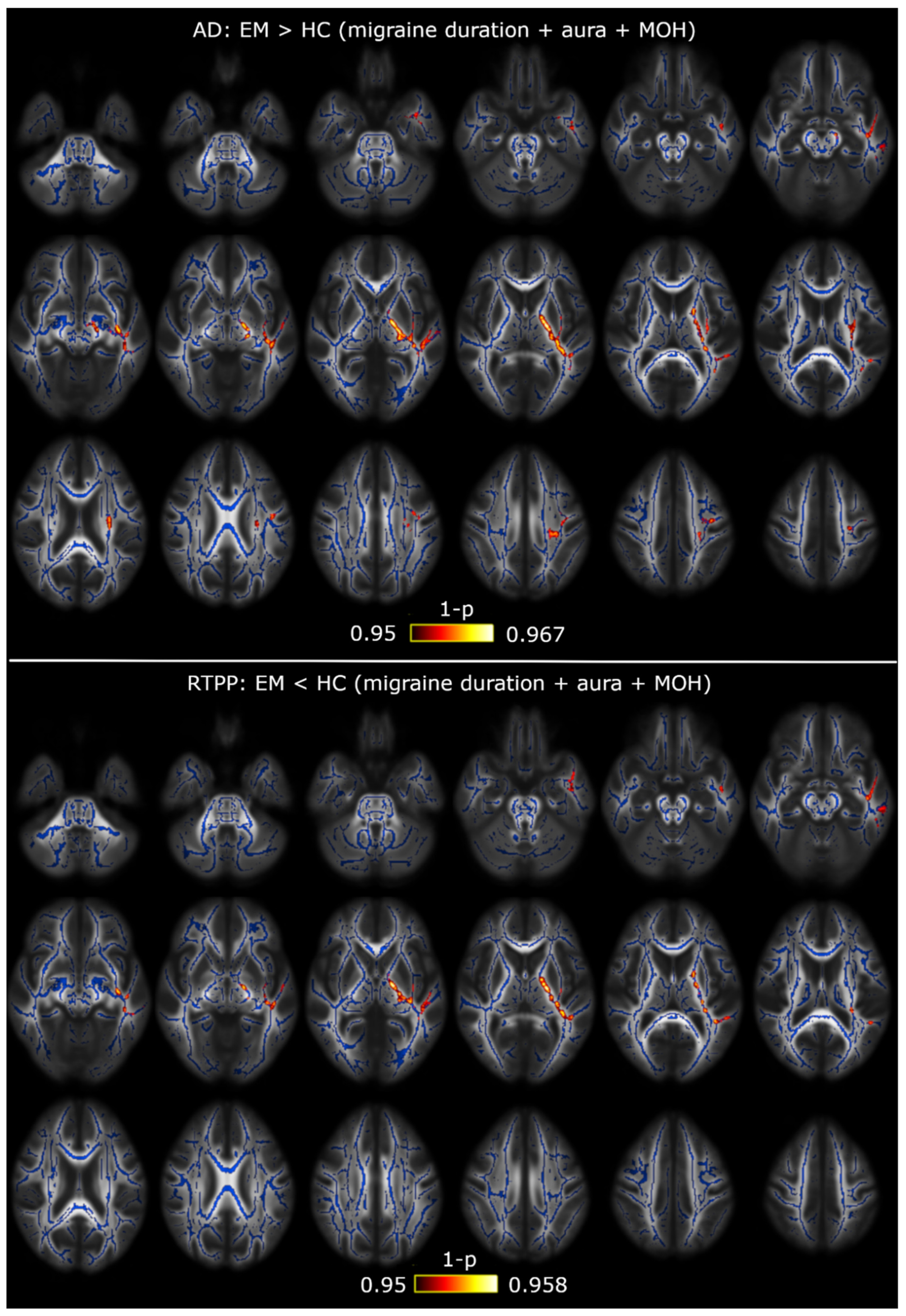 Brainsci 10 00711 g0a6 Brainsci 10 00711 g0a6