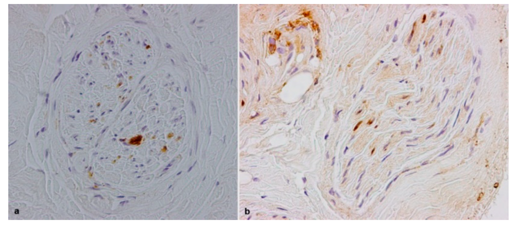 Brainsci 10 00780 g004
