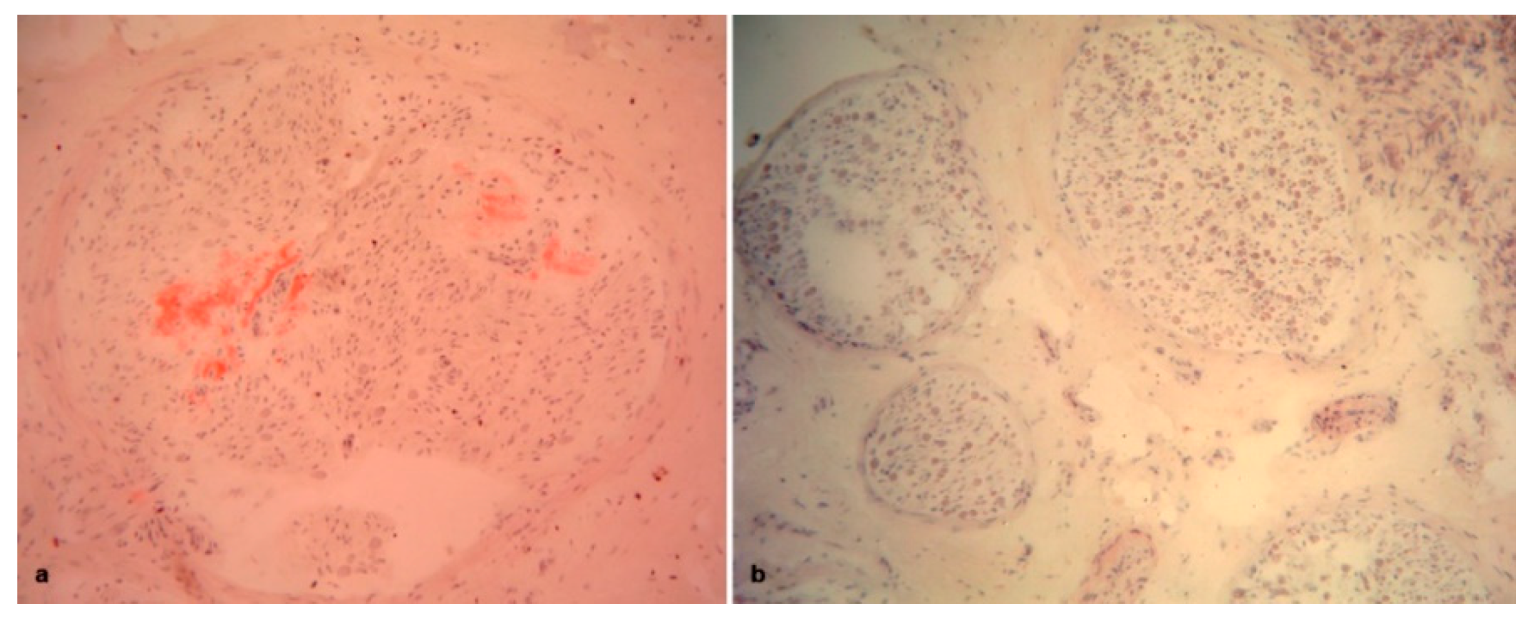 Brainsci 10 00780 g005