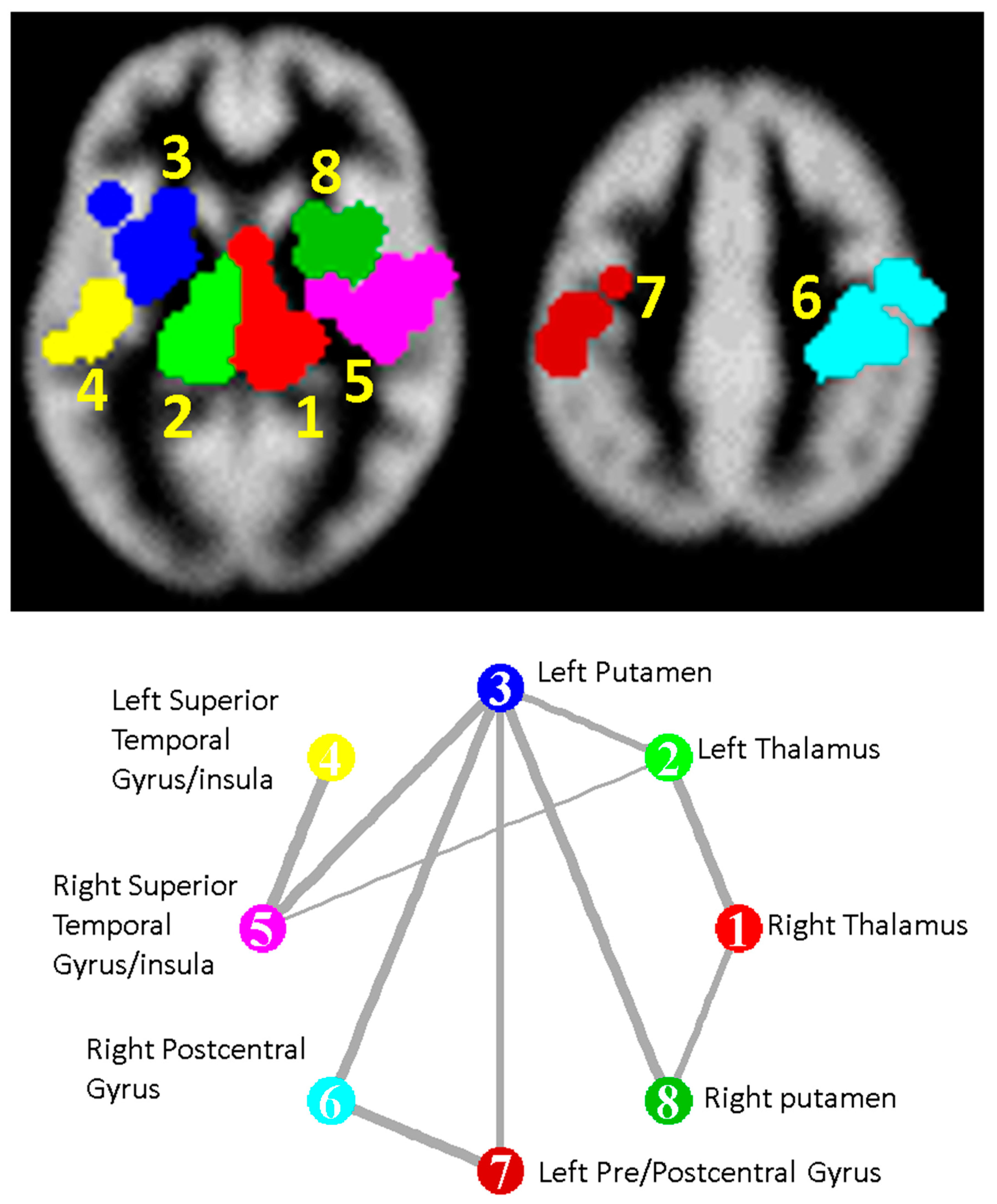 Brainsci 10 00798 g002 Brainsci 10 00798 g002