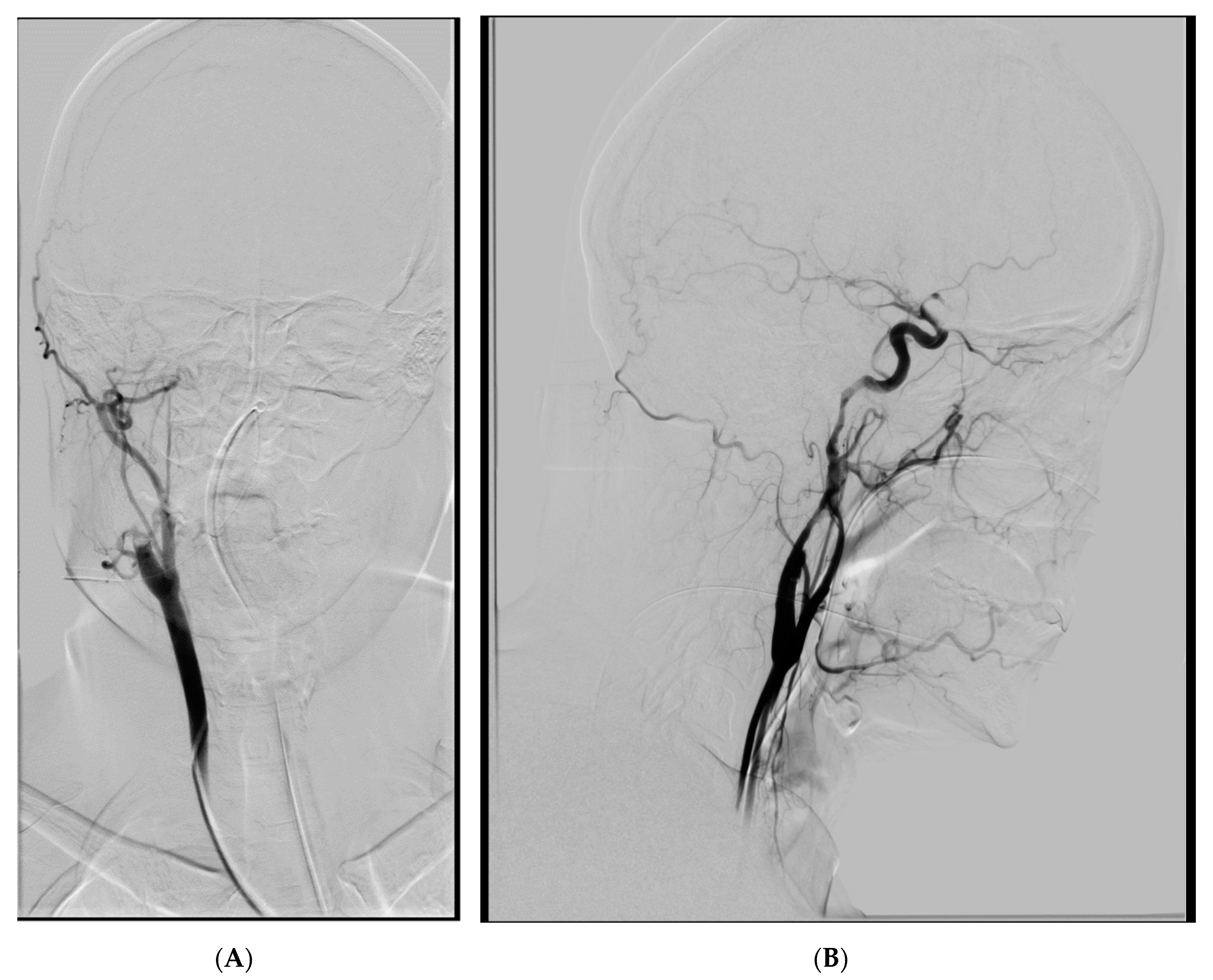 Brainsci 10 00800 g001 Brainsci 10 00800 g001