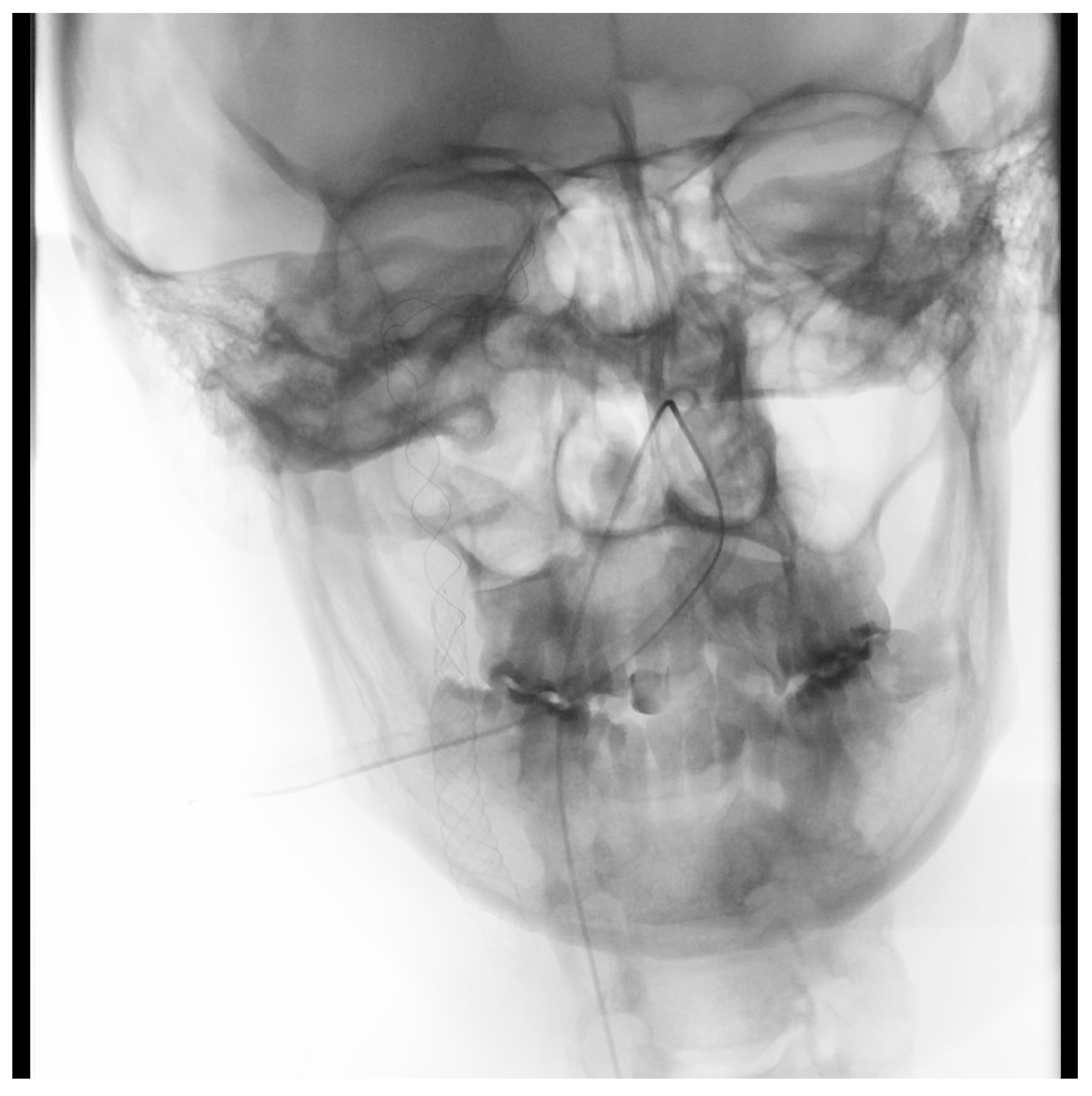 Brainsci 10 00800 g002 Brainsci 10 00800 g002