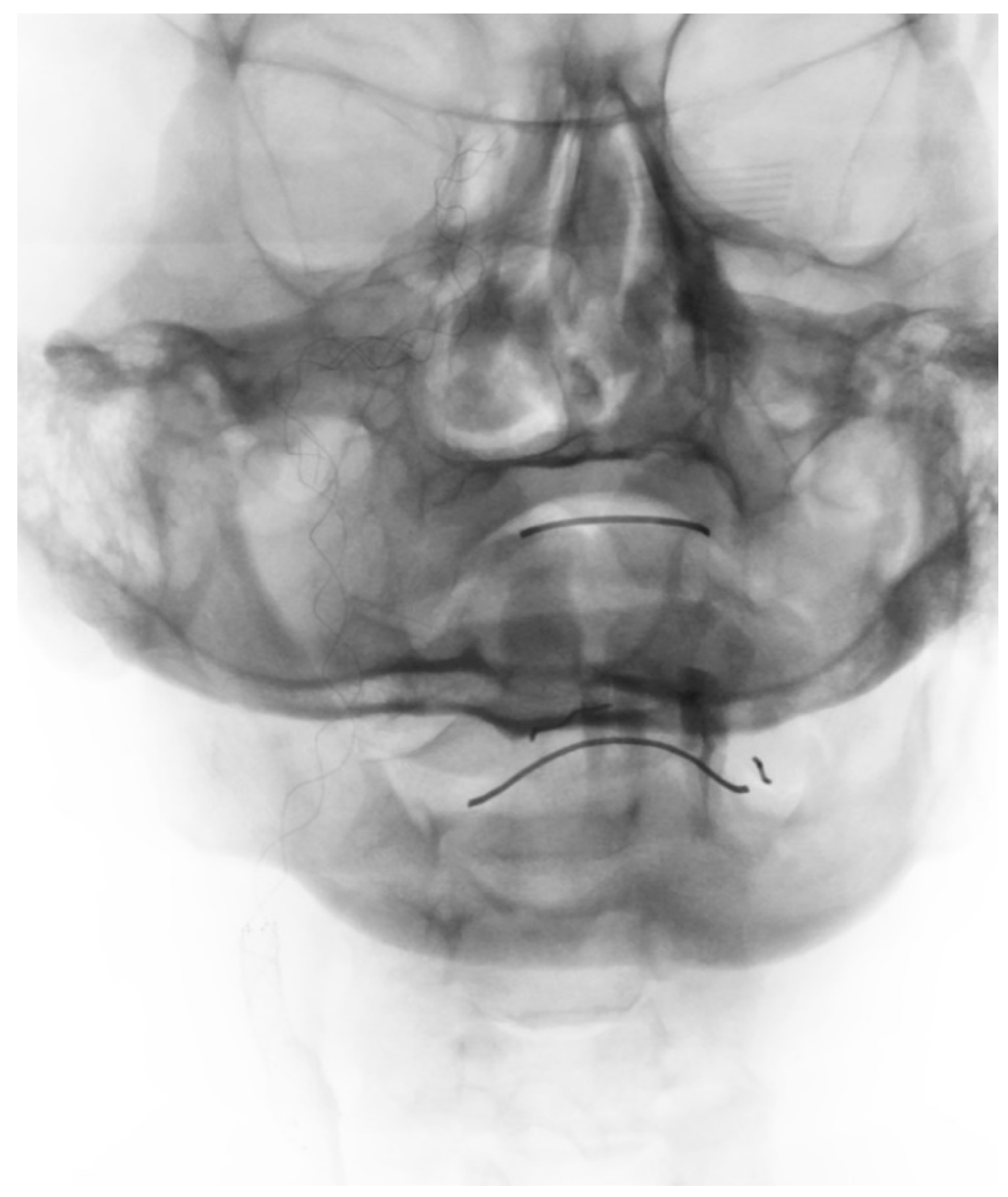 Brainsci 10 00800 g004 Brainsci 10 00800 g004