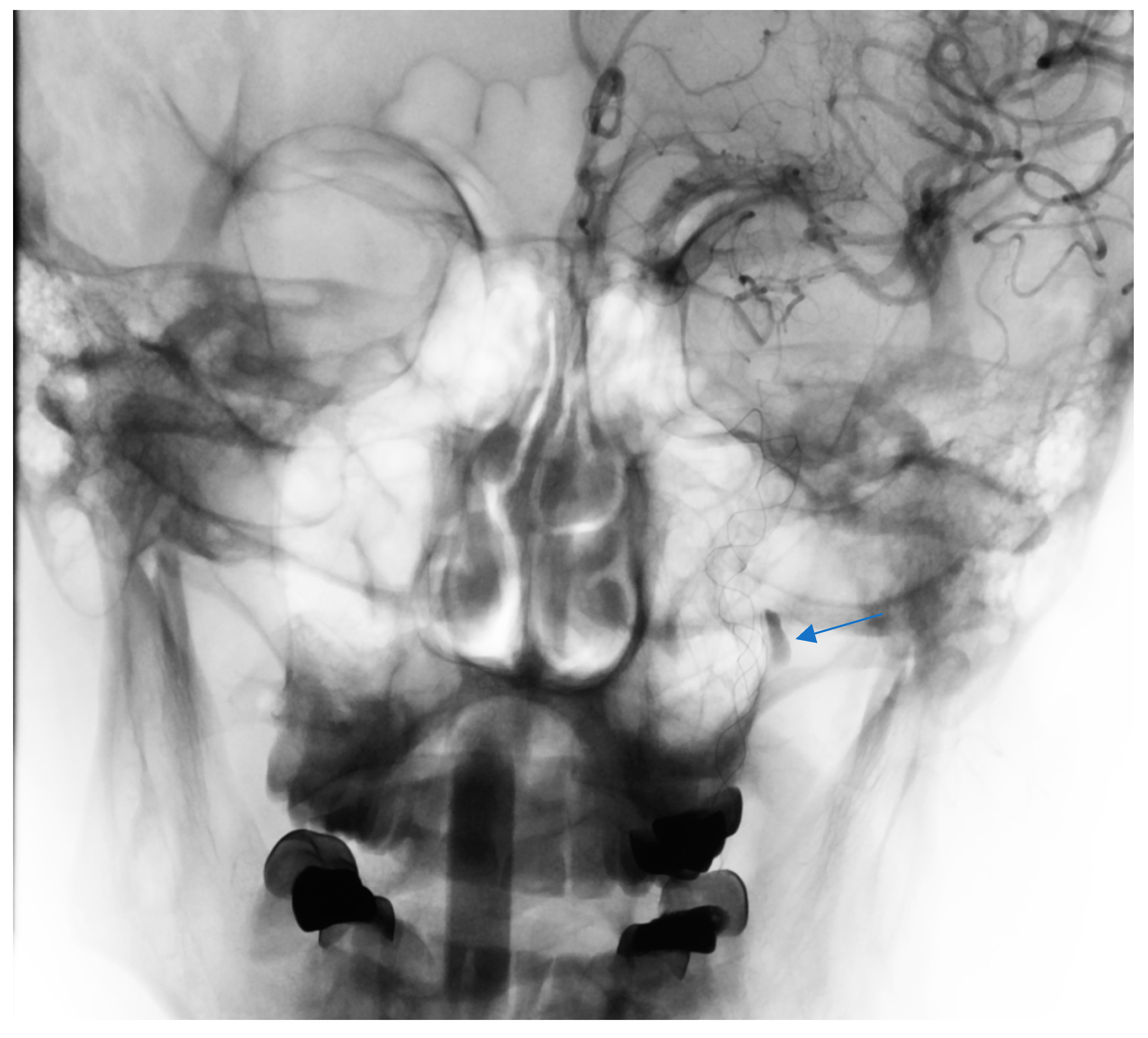 Brainsci 10 00800 g005 Brainsci 10 00800 g005
