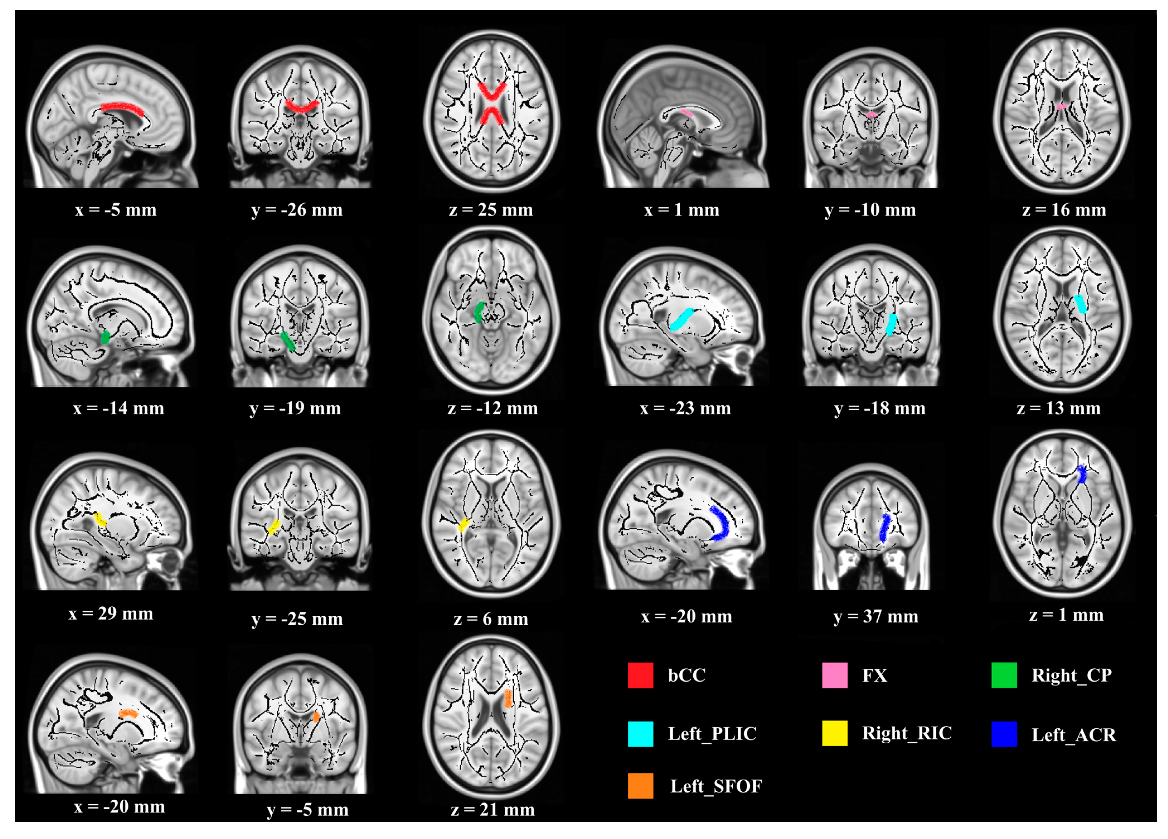 Brainsci 10 00803 g001