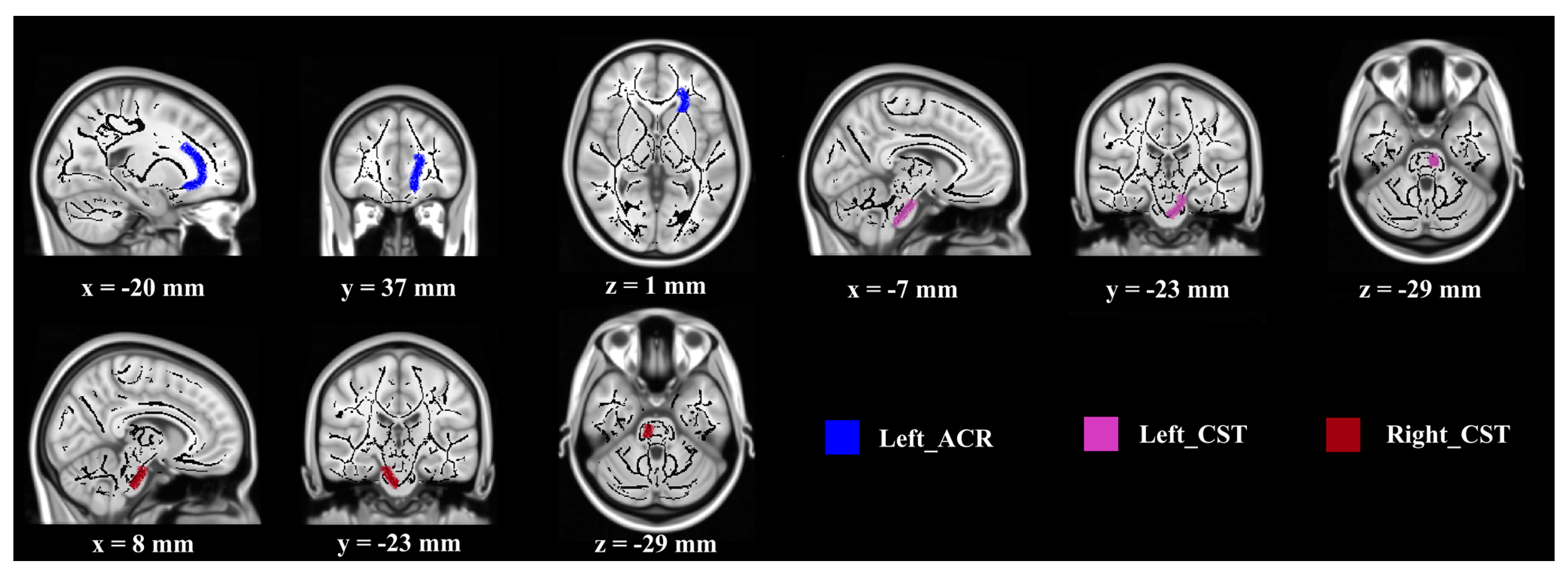 Brainsci 10 00803 g002
