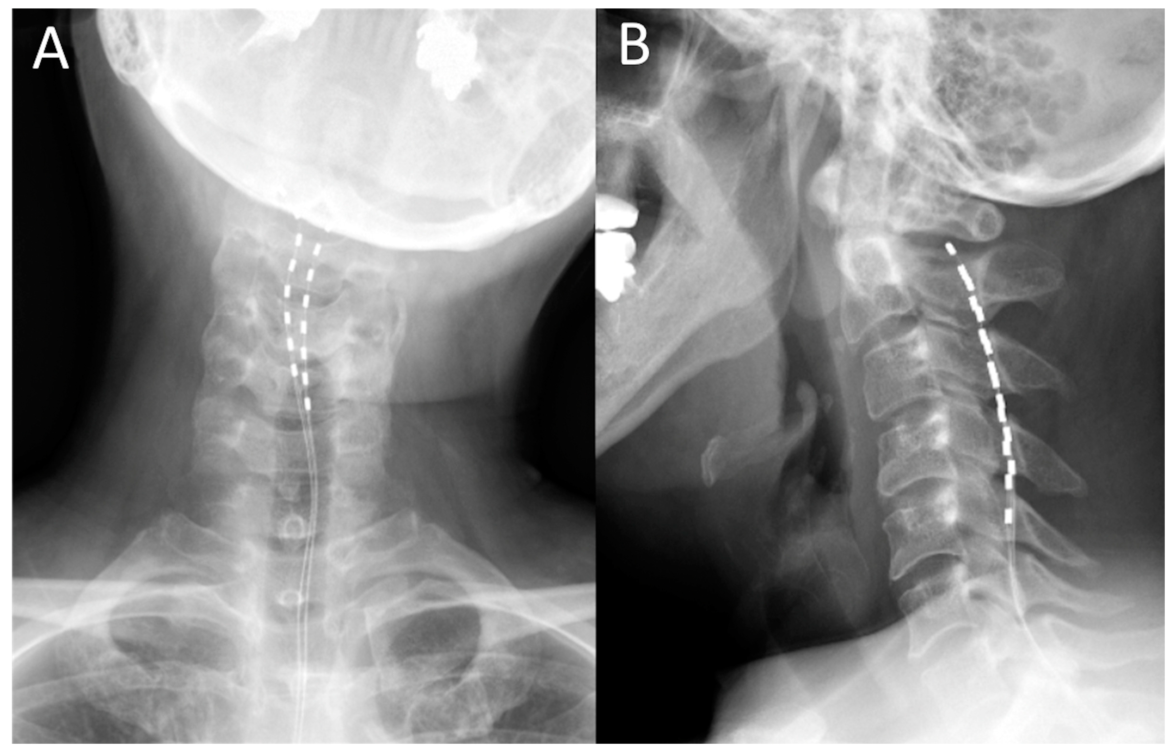 Brainsci 10 00827 g001
