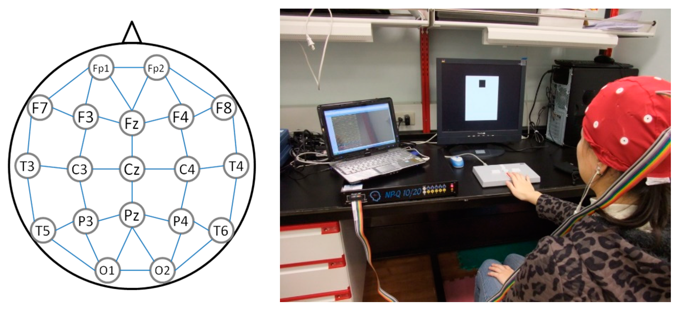 Brainsci 10 00828 g002 Brainsci 10 00828 g002