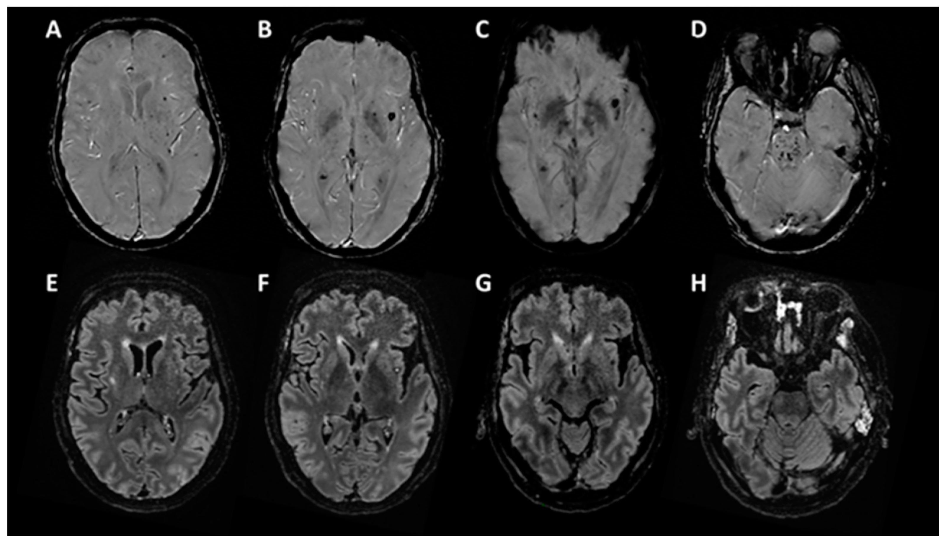 Brainsci 10 00845 g001 Brainsci 10 00845 g001