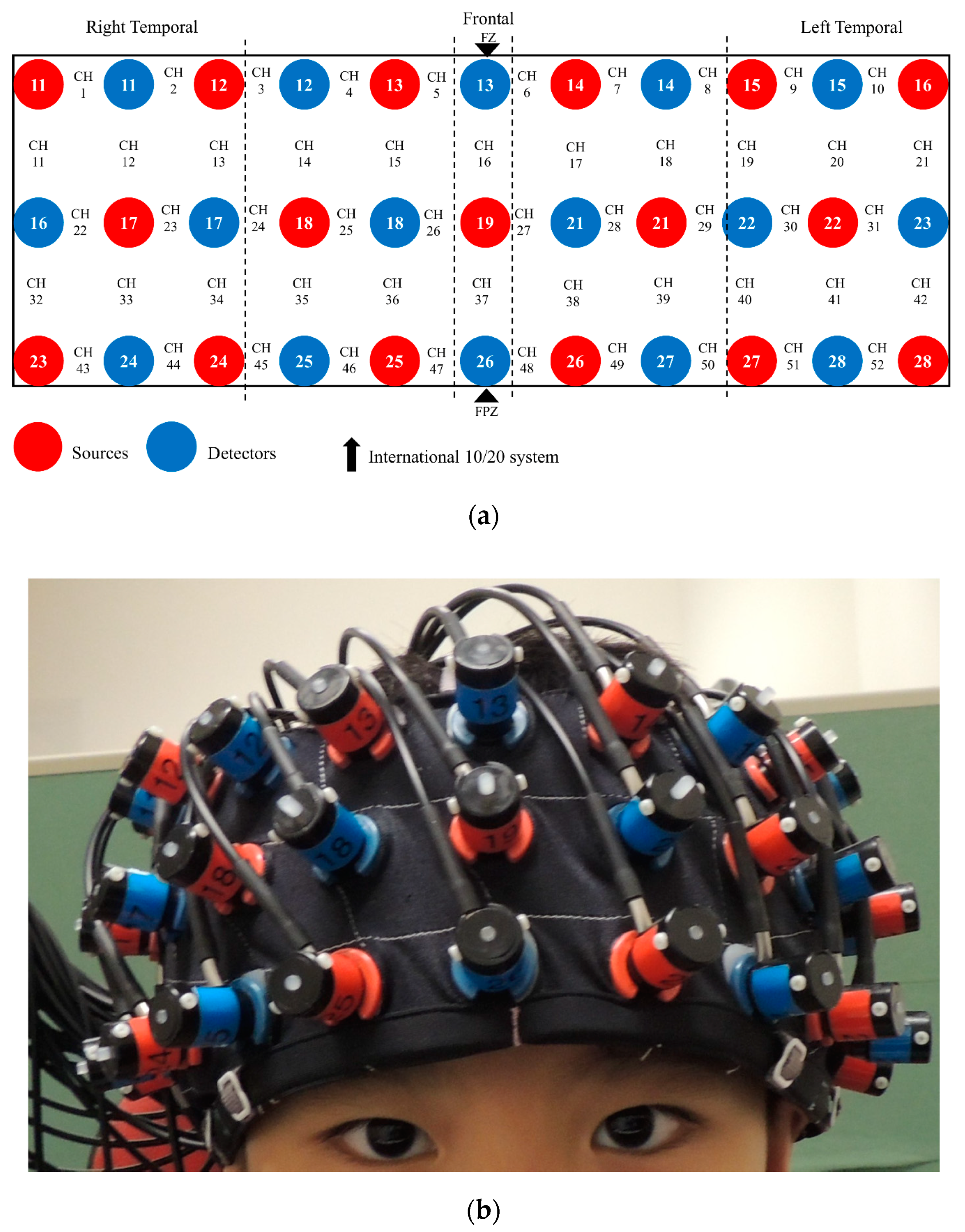 Brainsci 10 00880 g002 Brainsci 10 00880 g002