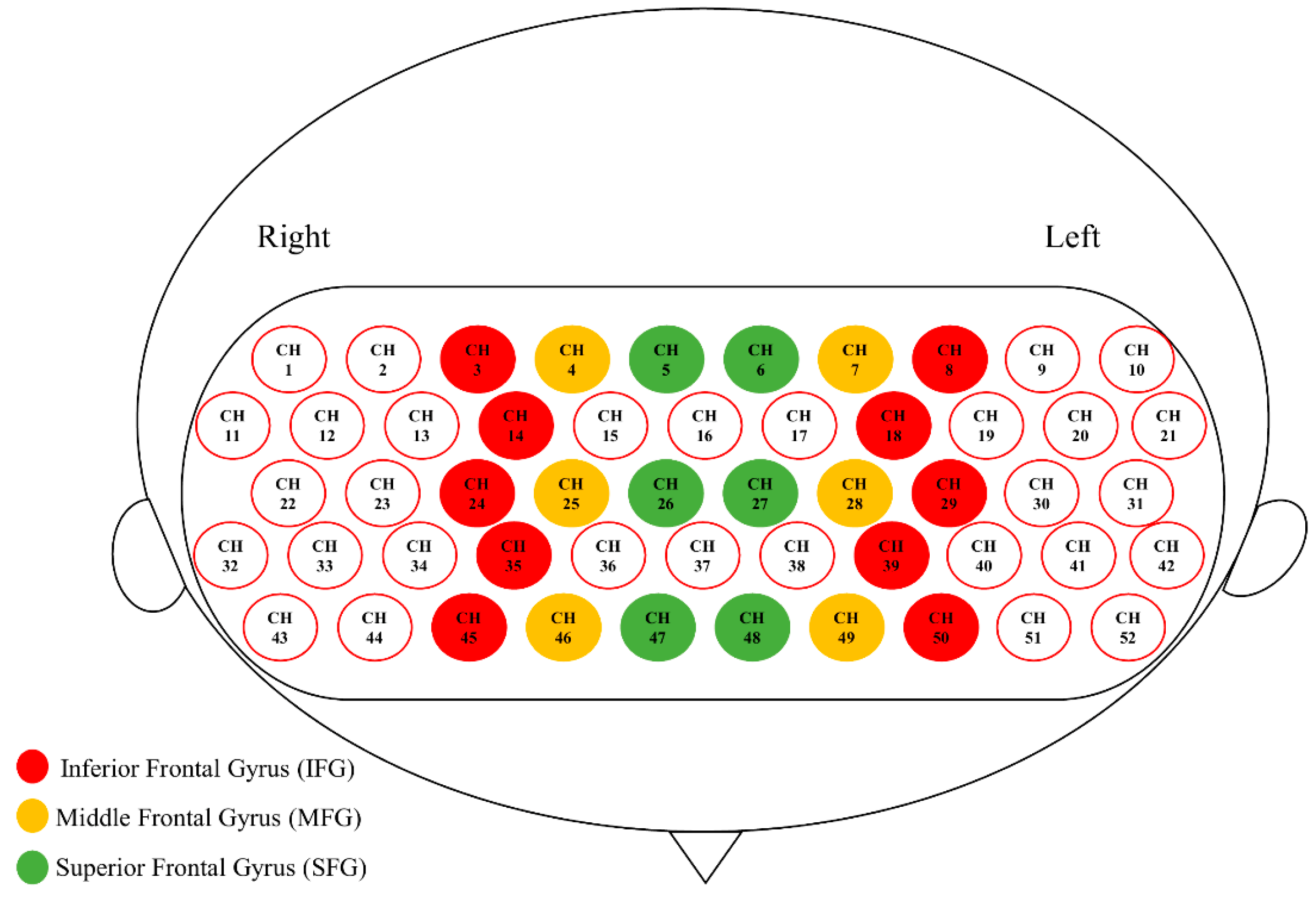 Brainsci 10 00880 g003 Brainsci 10 00880 g003