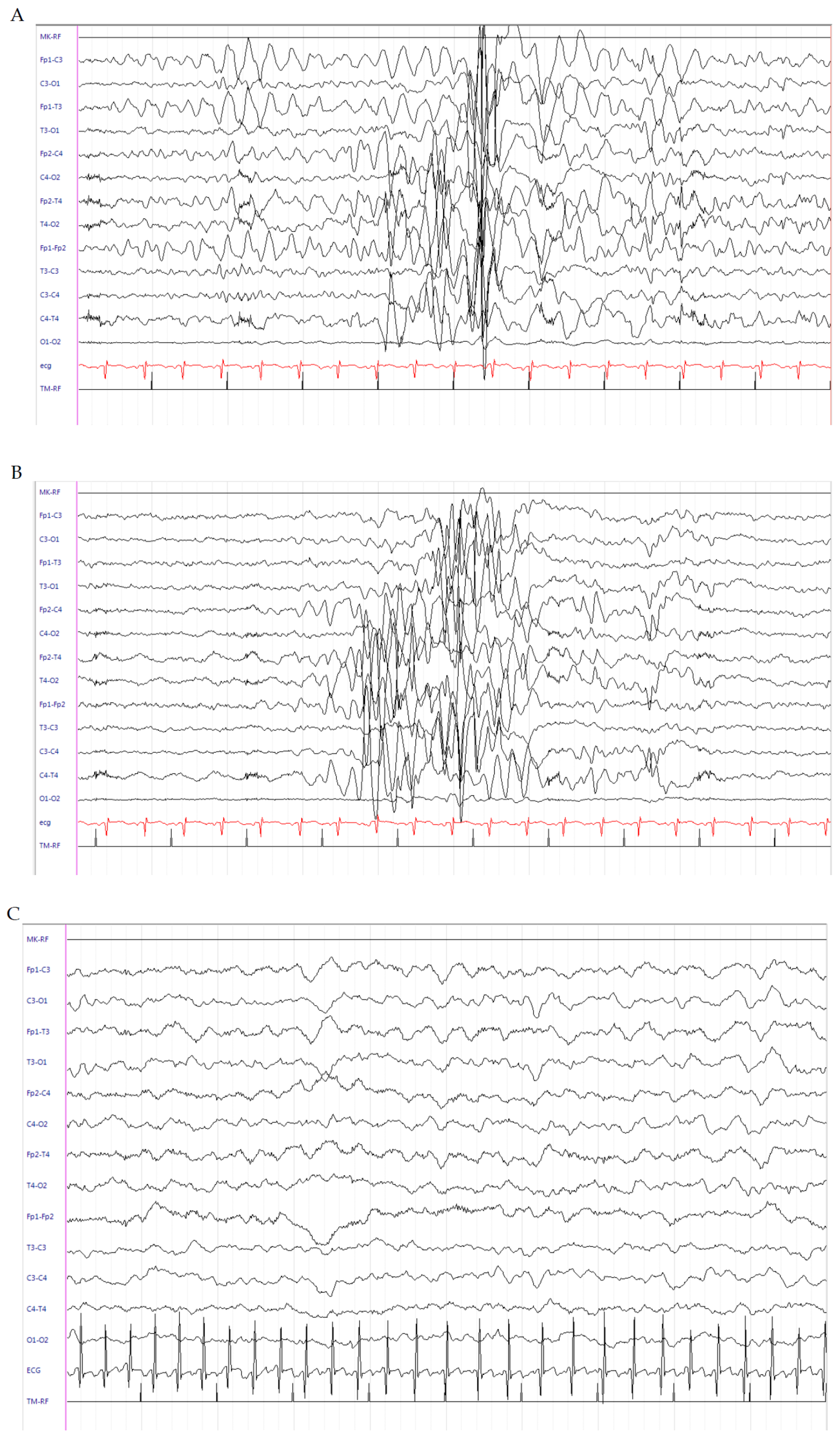 Brainsci 10 00885 g001