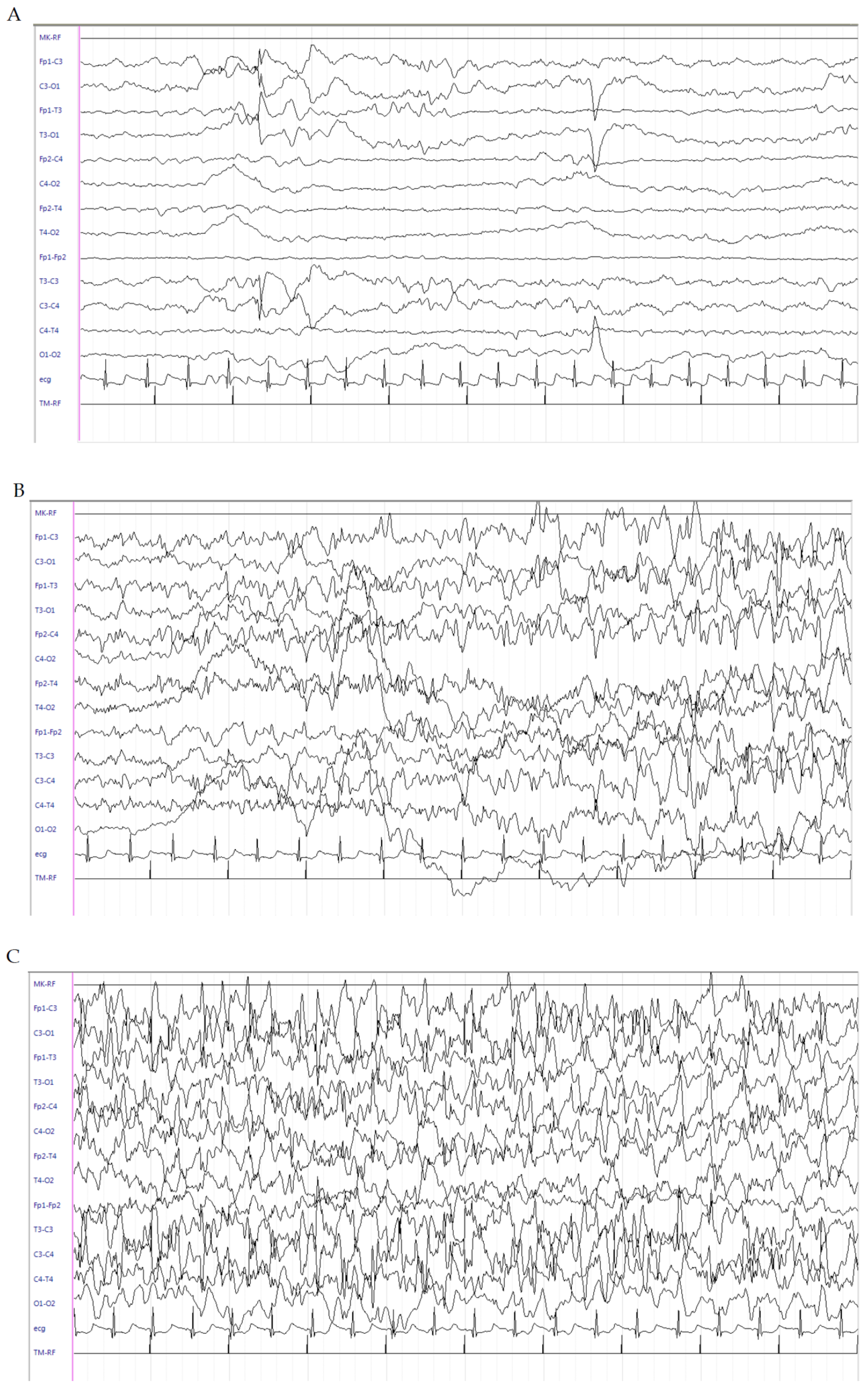 Brainsci 10 00885 g002a