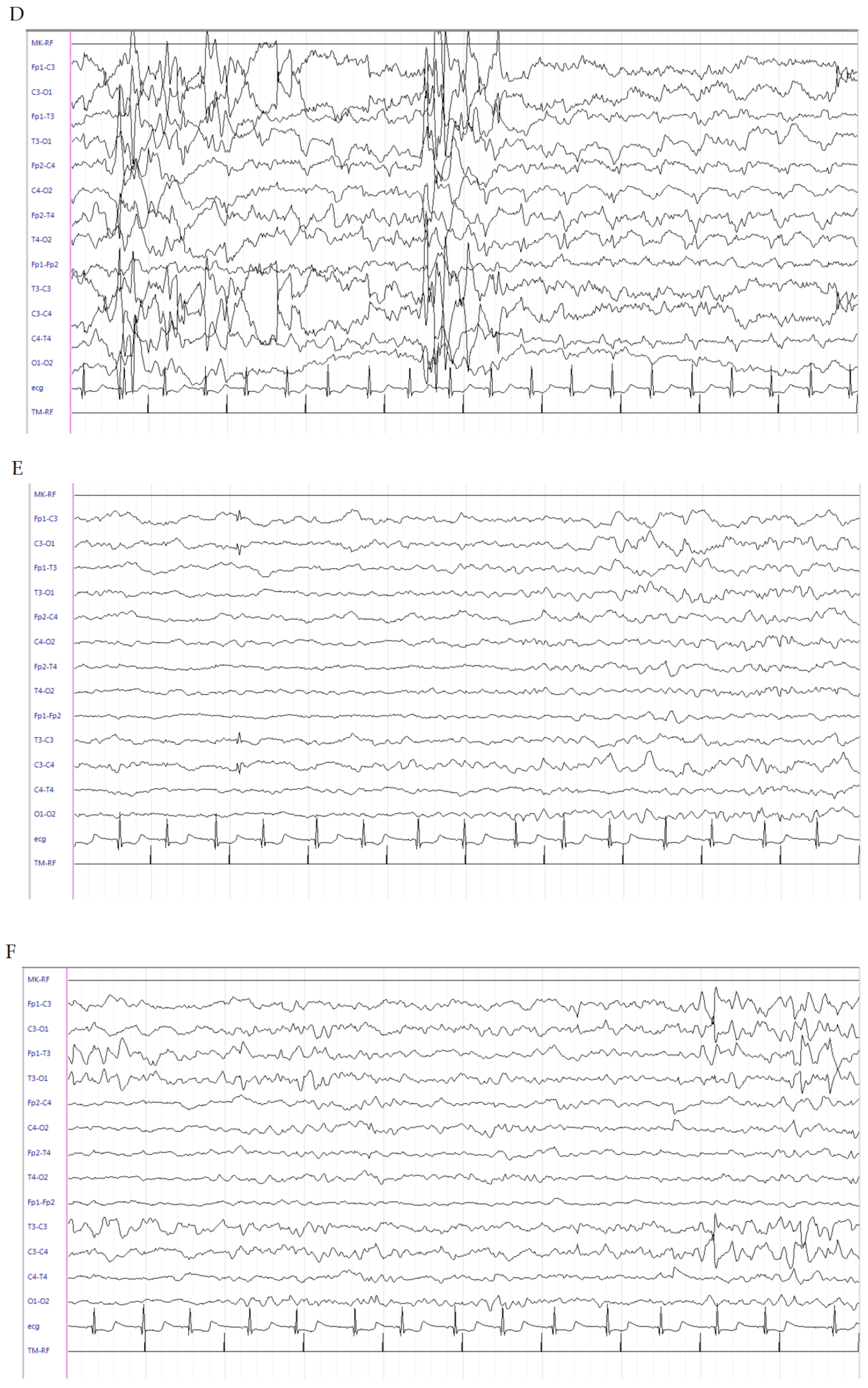 Brainsci 10 00885 g002b