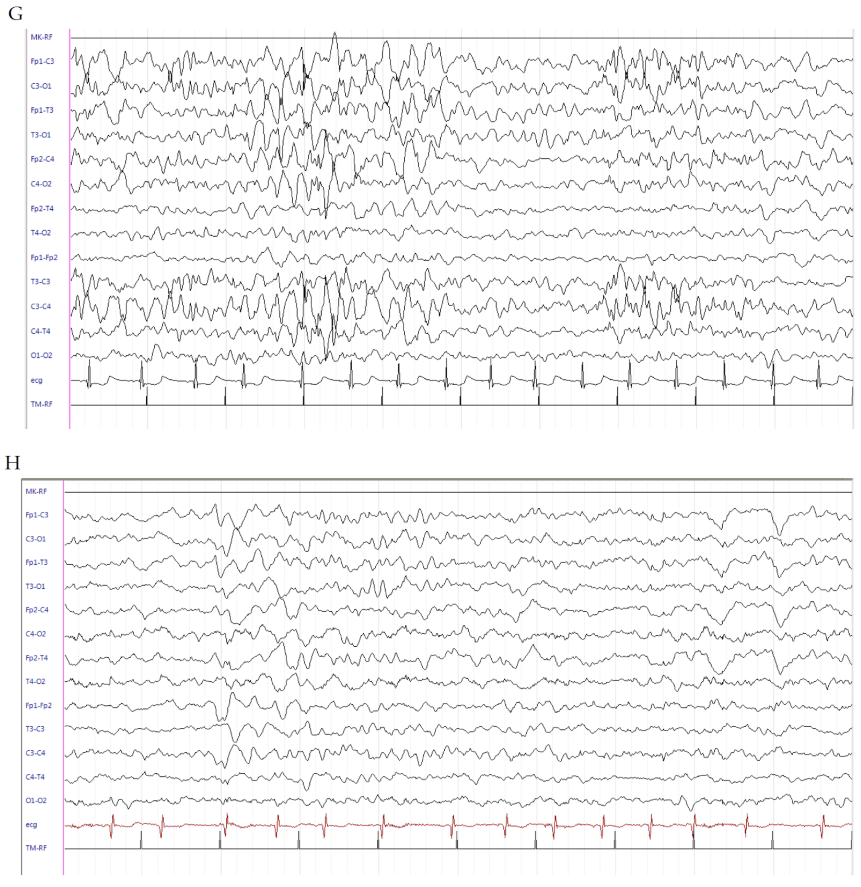 Brainsci 10 00885 g002c