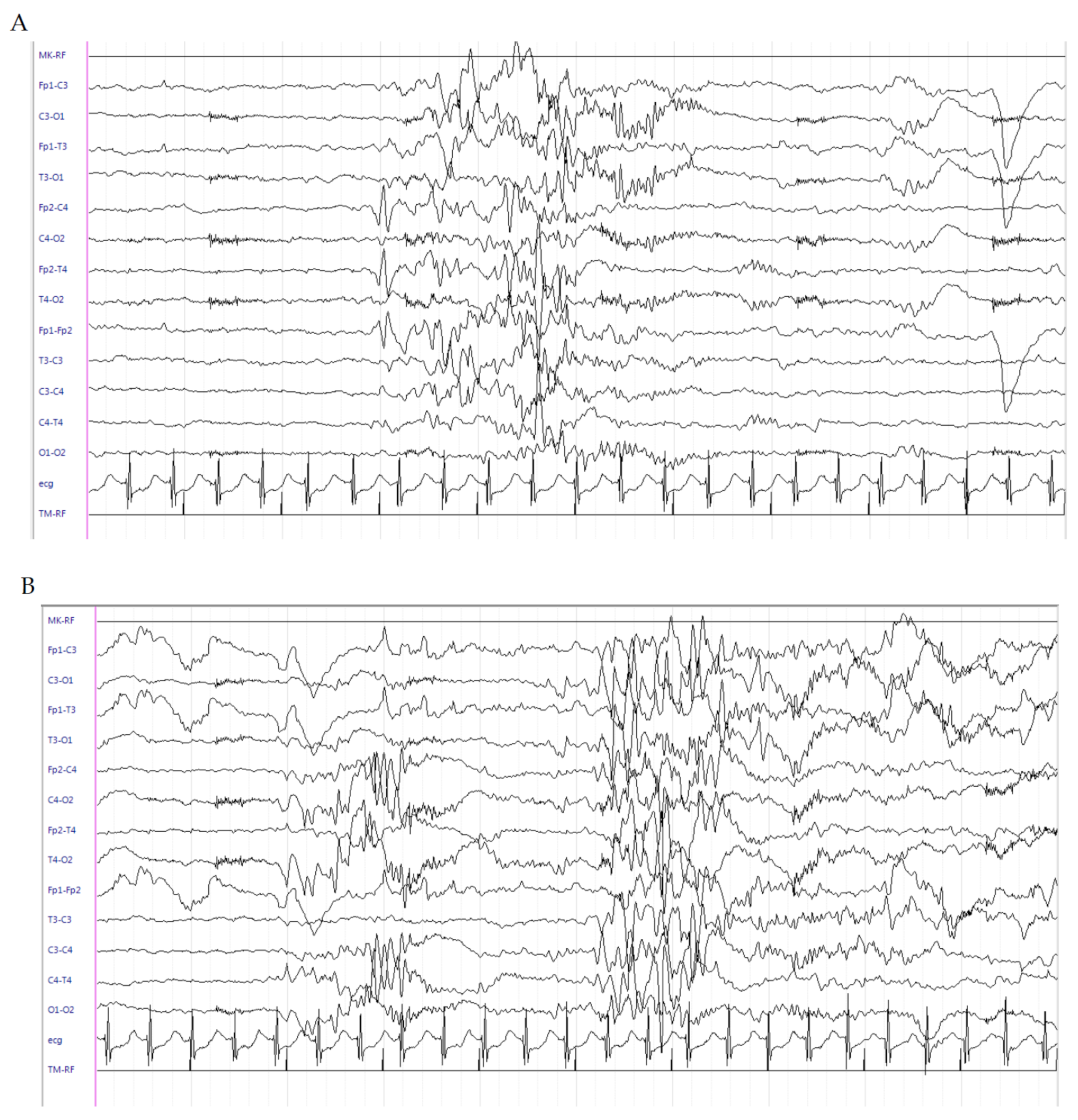 Brainsci 10 00885 g003a