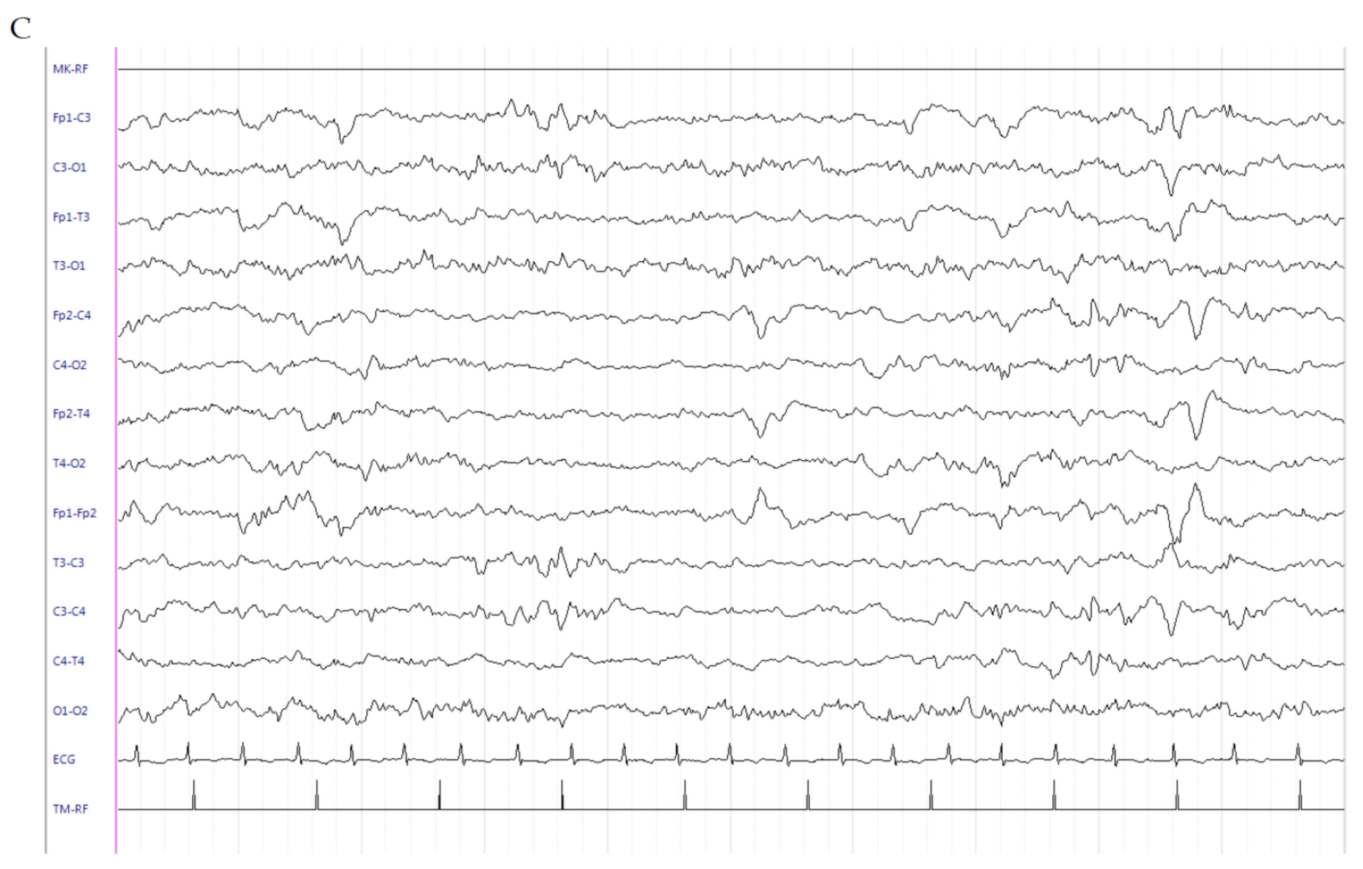 Brainsci 10 00885 g003b