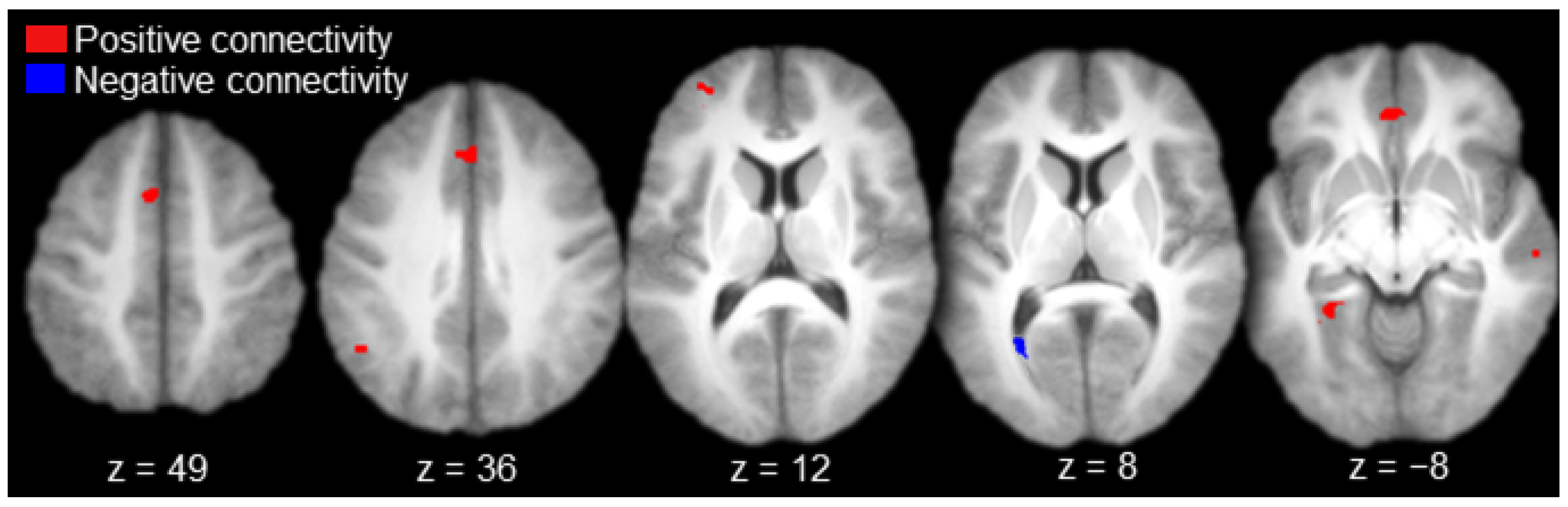 Brainsci 10 00898 g003 Brainsci 10 00898 g003