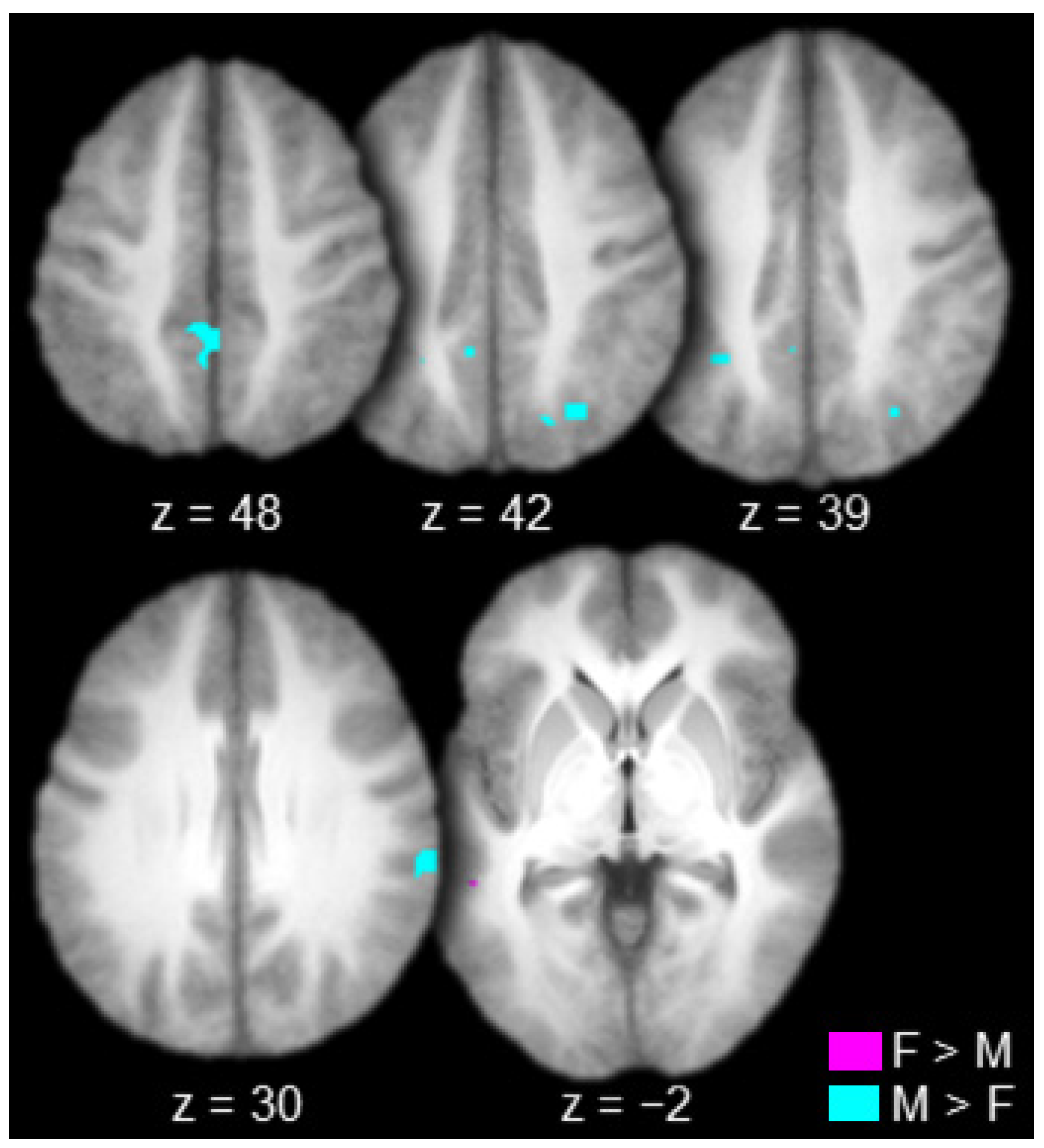 Brainsci 10 00898 g006 Brainsci 10 00898 g006
