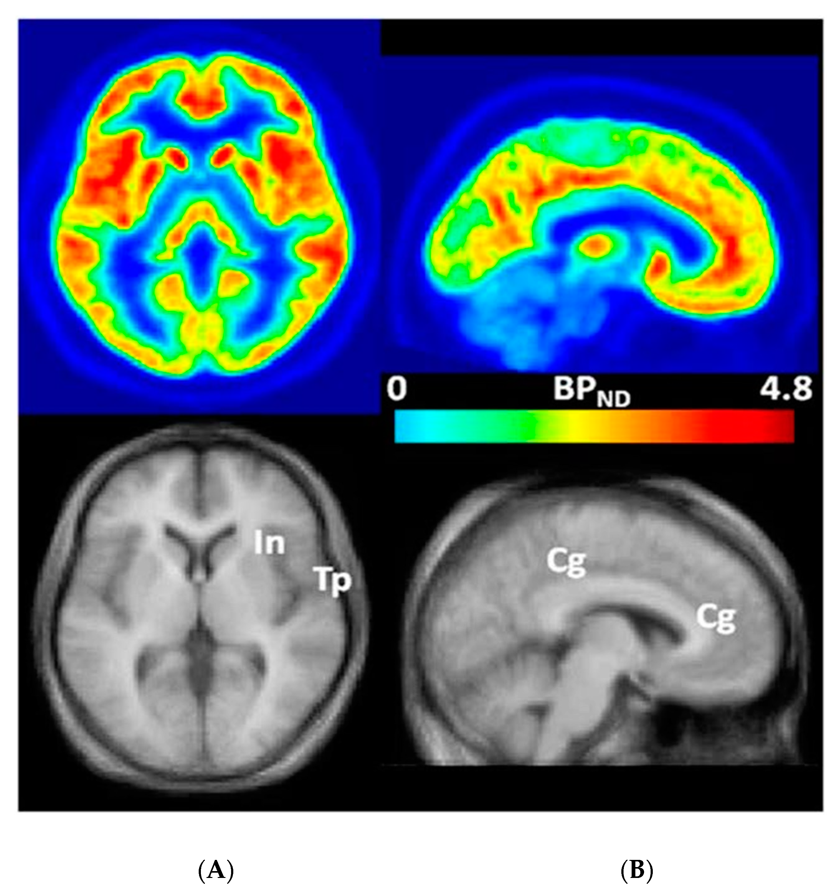 Brainsci 10 00899 g001 Brainsci 10 00899 g001