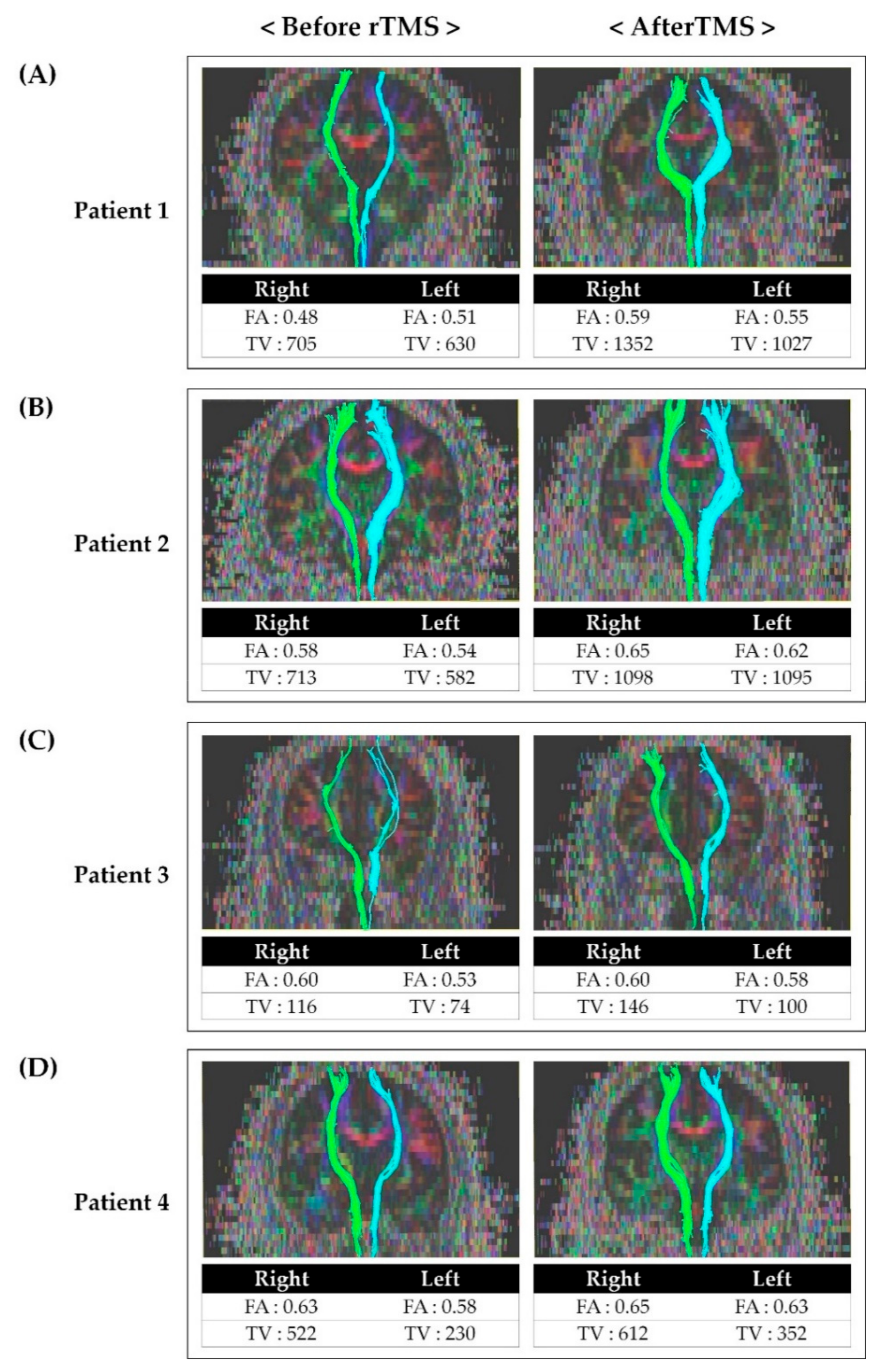 Brainsci 10 00929 g002 Brainsci 10 00929 g002