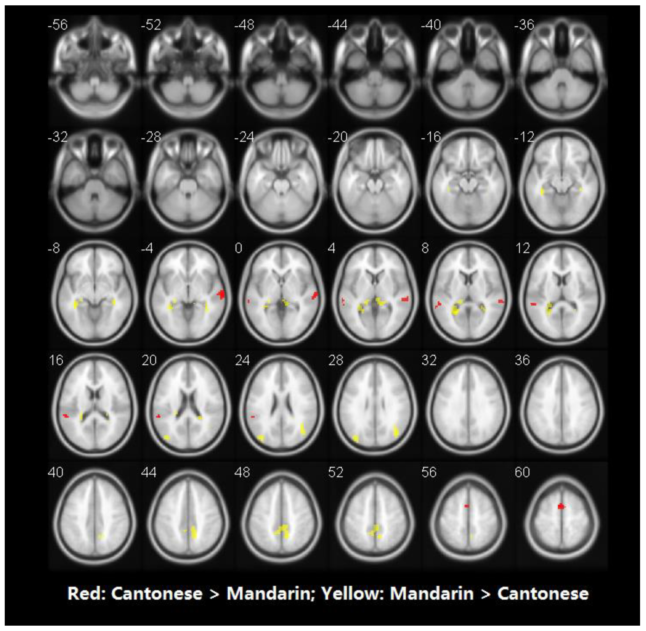Brainsci 10 00936 g005